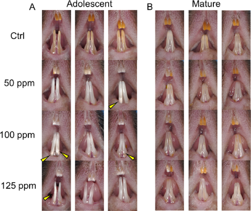 Developmental vulnerability to fluoride toxicity: enamel and clearance differences in adolescent versus mature mice