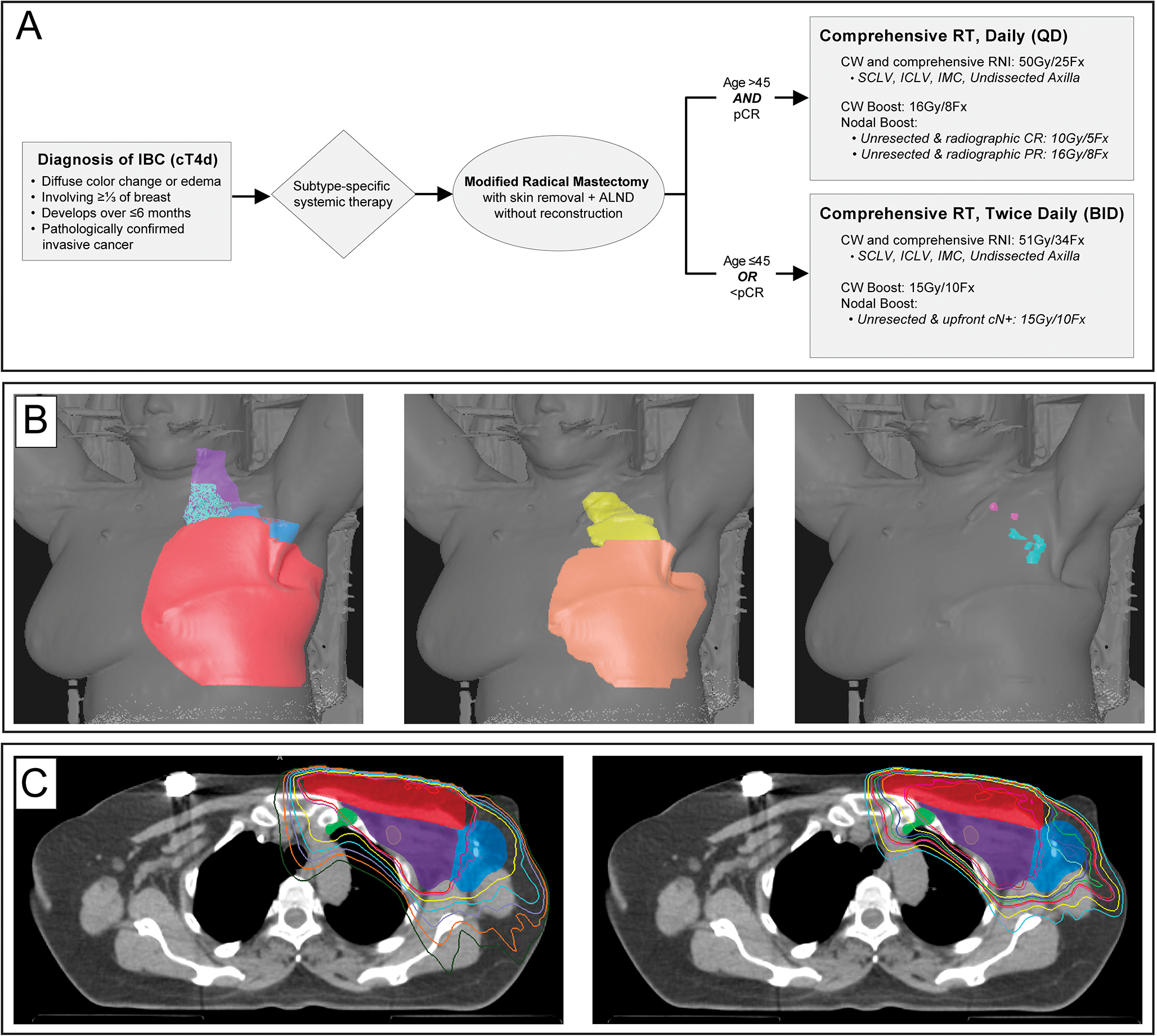 Contemporary Locoregional Therapy for Inflammatory Breast Cancer: Don’t De-Escalate Off Protocol