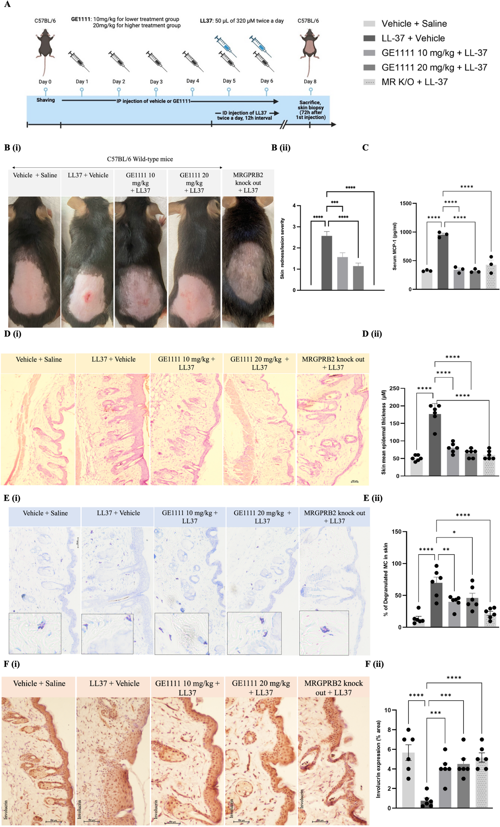 Therapeutic effect of an MRGPRX2/MRGPRB2 antagonist on LL-37-induced rosacea-like inflammation in mice