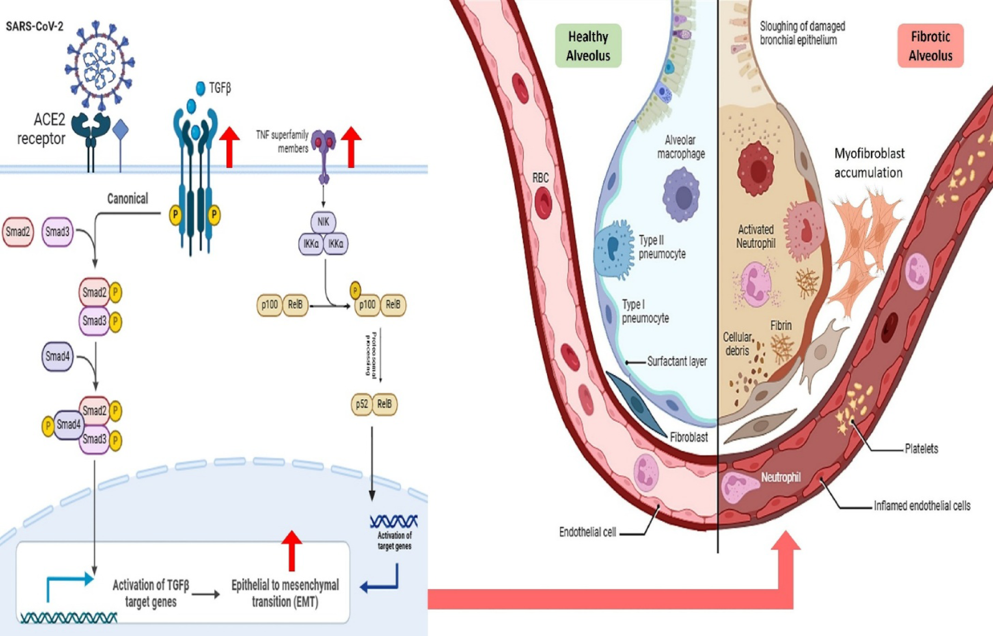 Pulmonary fibrosis in post-COVID-19: epithelial-mesenchymal transition as a key mechanism and target for therapy
