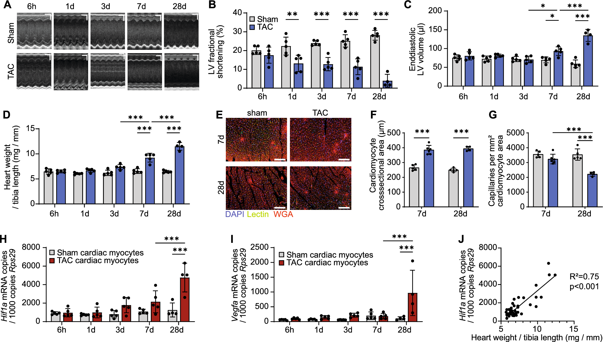 Downregulation of TCF19 and ATAD2 causes endothelial cell cycle arrest at the transition from cardiac hypertrophy to heart failure
