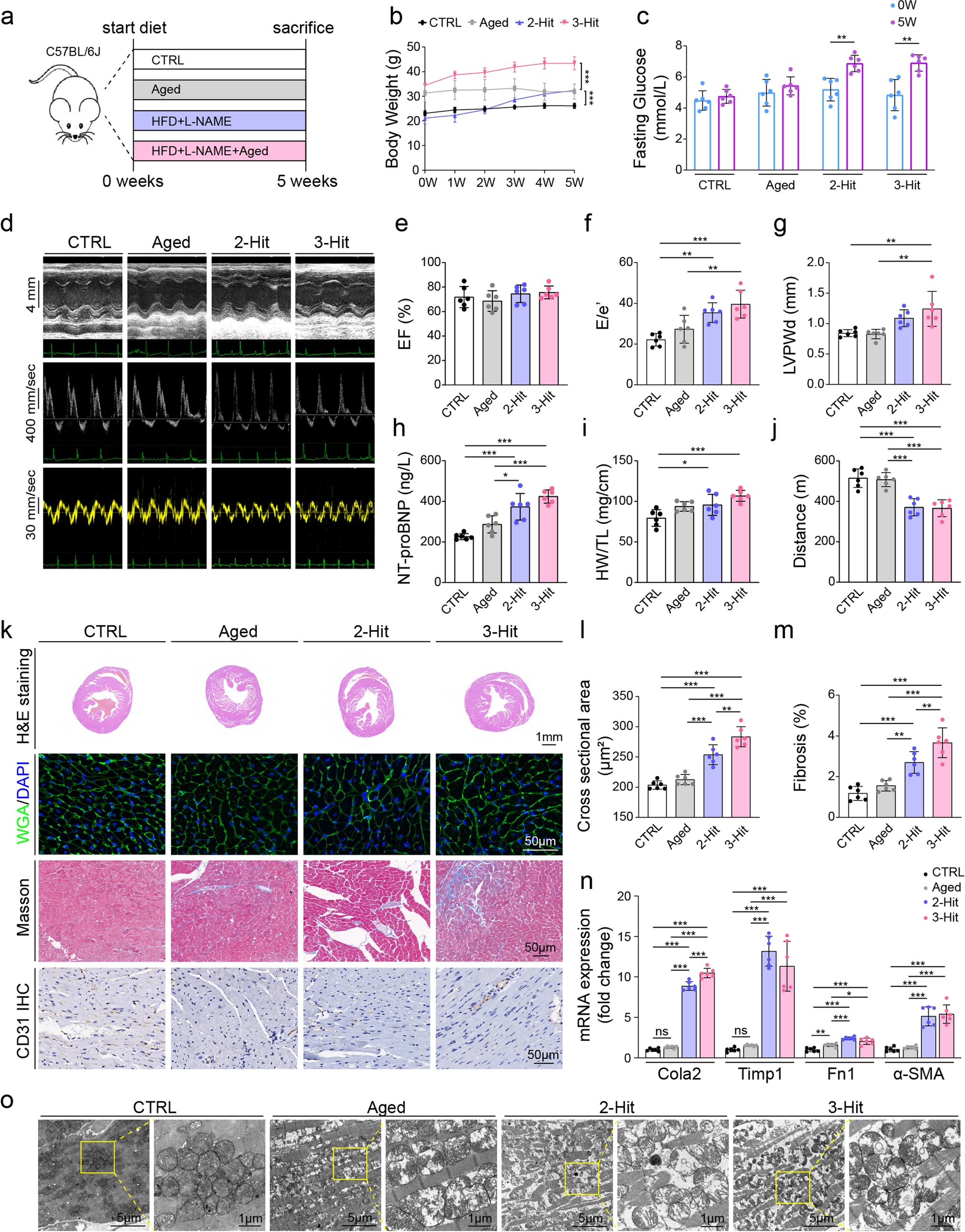 Renal denervation attenuates cardiac dysfunction in HFpEF by inhibiting the ATP-P2X7-NLRP3 inflammasome axis