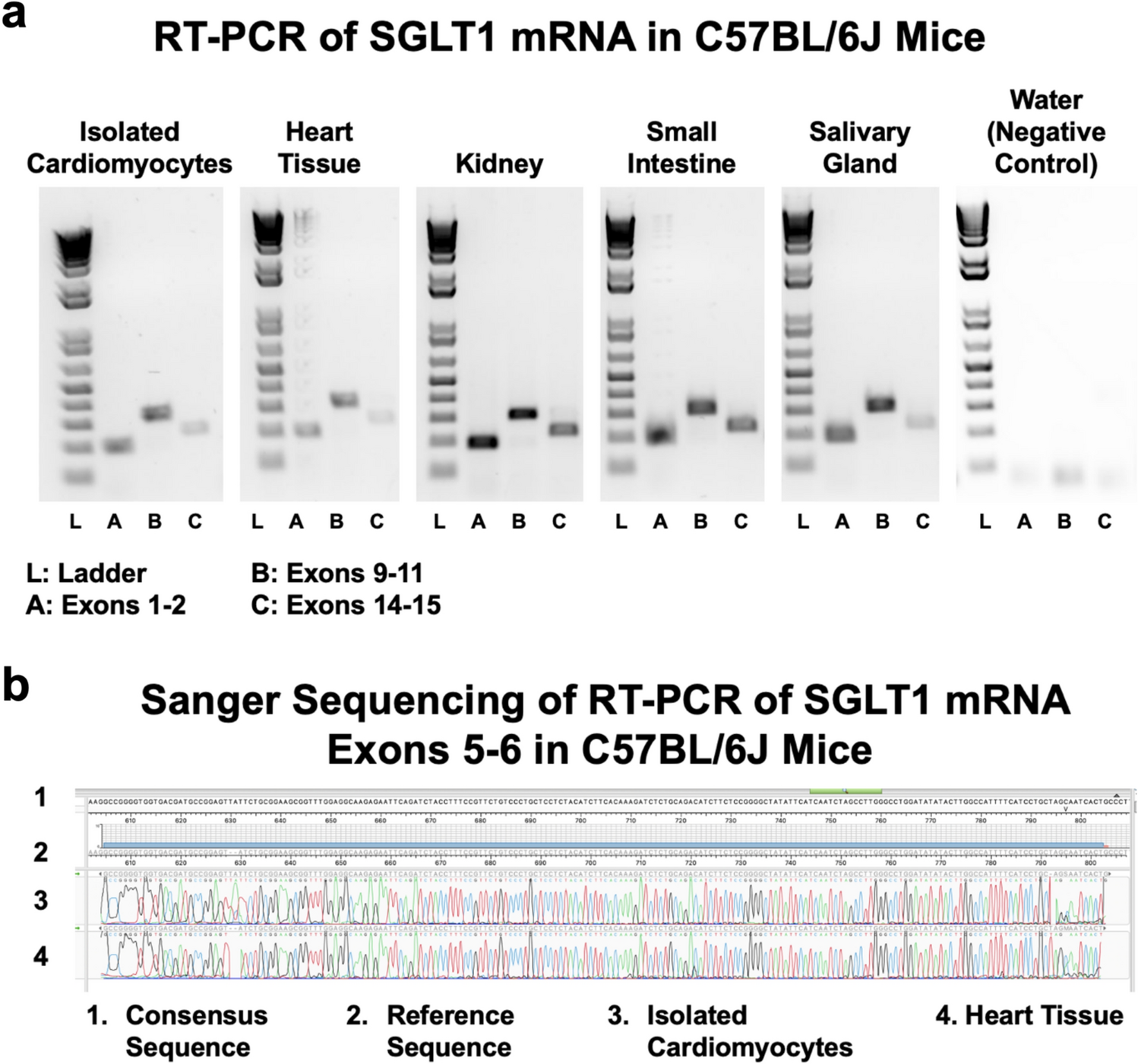 Cardiac sodium-glucose co-transporter 1 (SGLT1) contributes to heart failure in a mouse model of diabetic cardiomyopathy