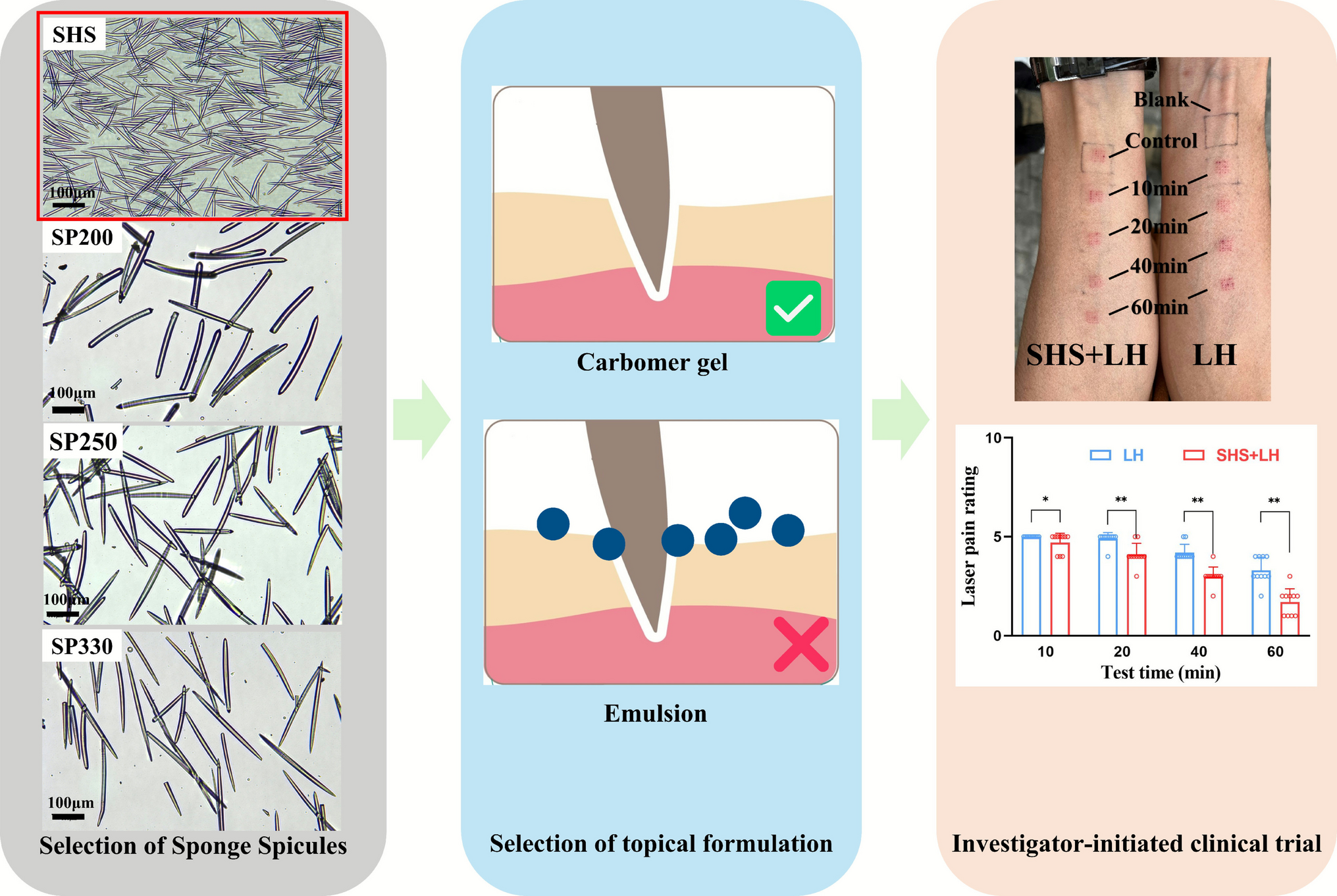 Topical delivery of Lidocaine using spicules for local anesthesia