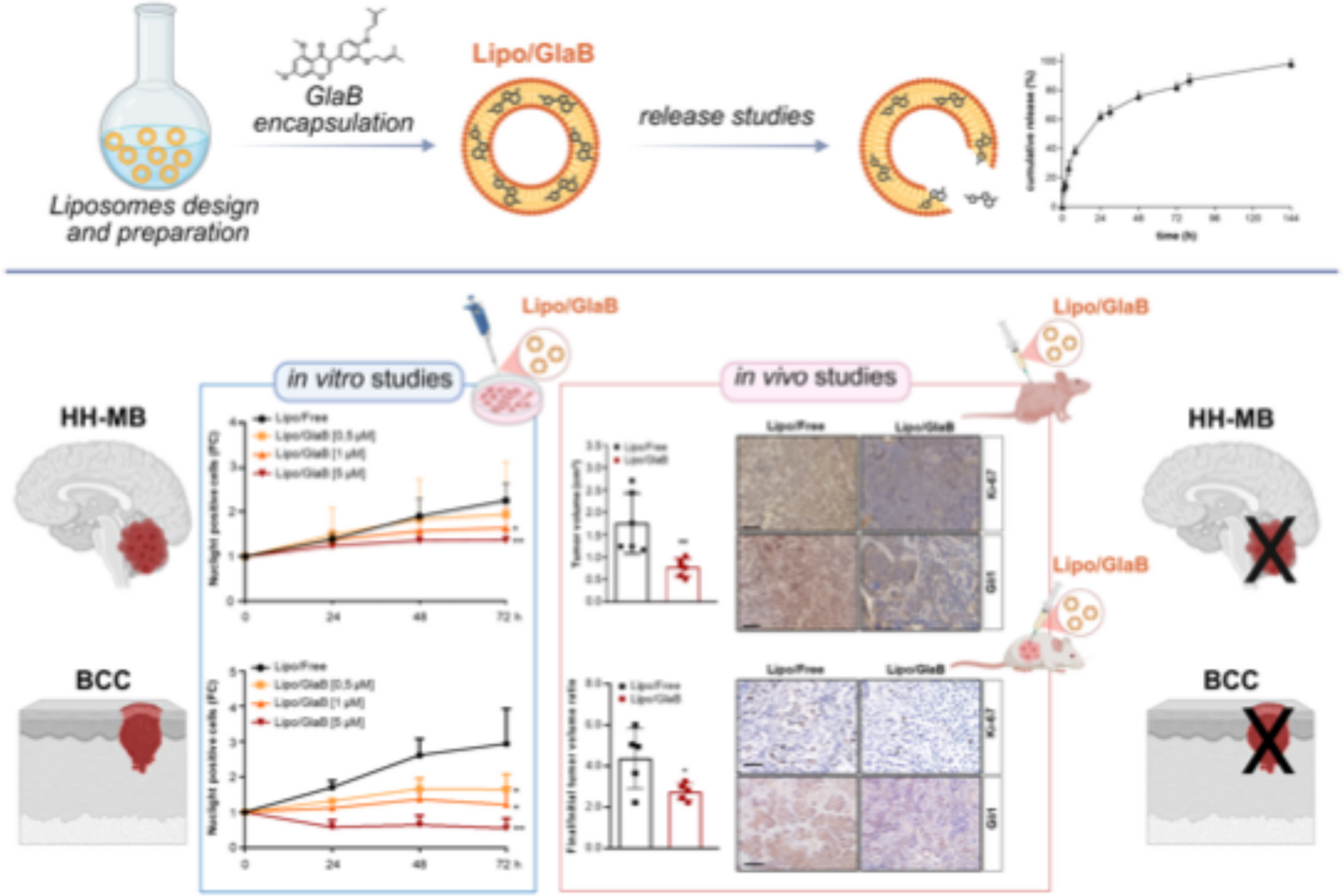 Functional and therapeutic effects of Glabrescione B delivery by liposomes on Hedgehog-dependent tumors