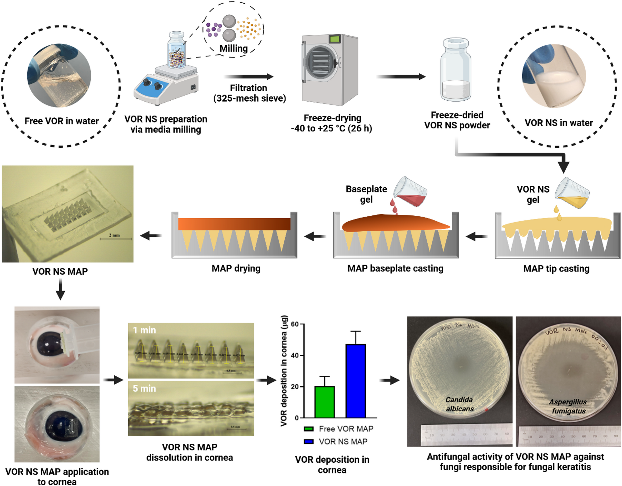 Voriconazole nanosuspension-loaded ocular bilayer dissolving microneedle patch for the management of fungal keratitis