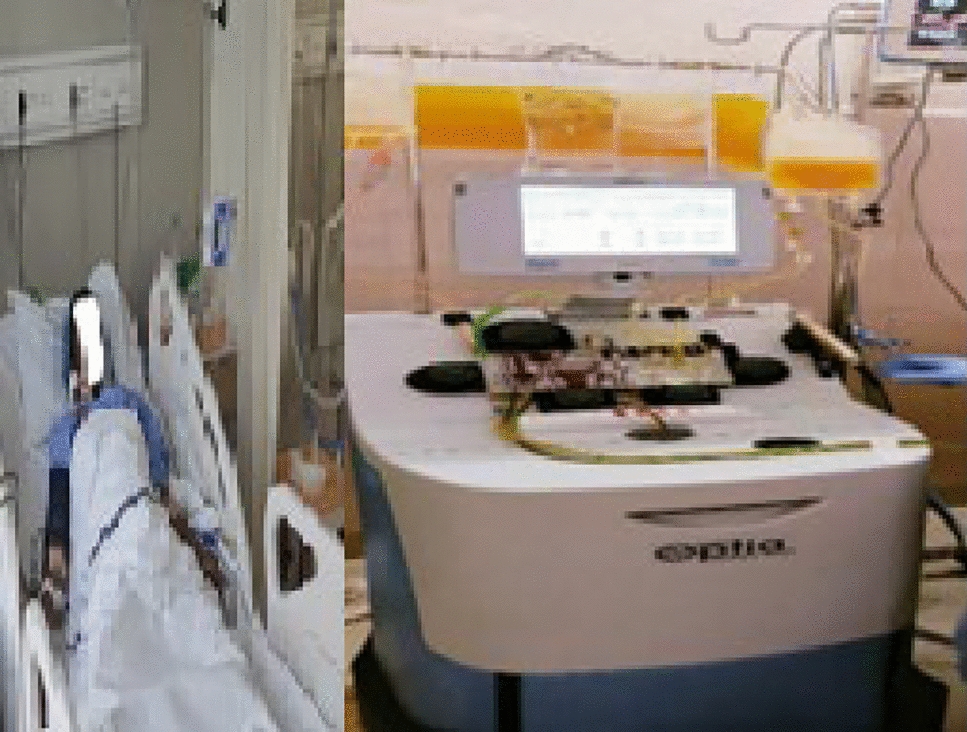 Therapeutic Plasma Exchange in HELLP Syndrome: Turning The Tide In Critical Care