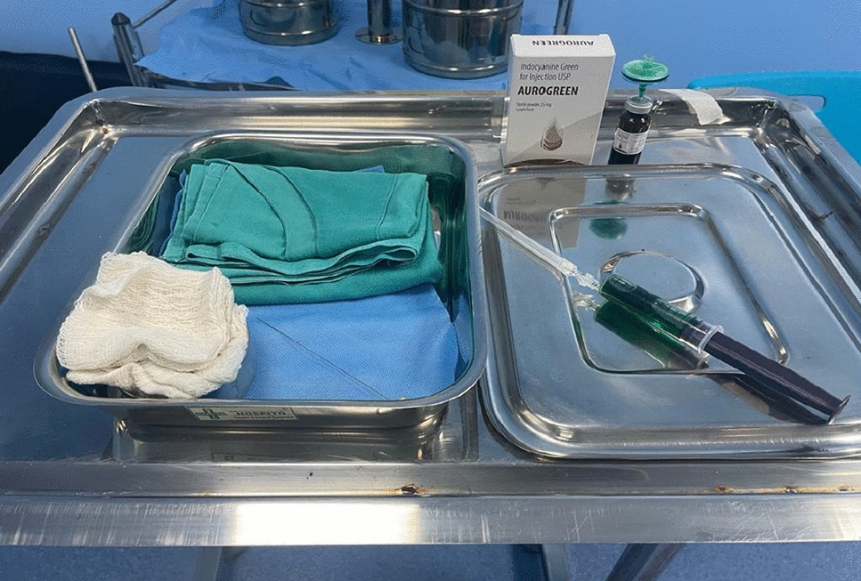 Sentinel Lymph Node Biopsy in Endometrial Carcinoma: A Prospective Feasibility Study