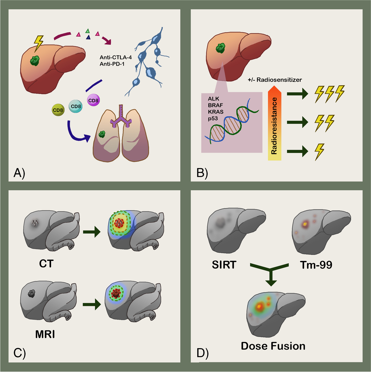 The Role of Ablative Radiotherapy to Liver Oligometastases from Colorectal Cancer