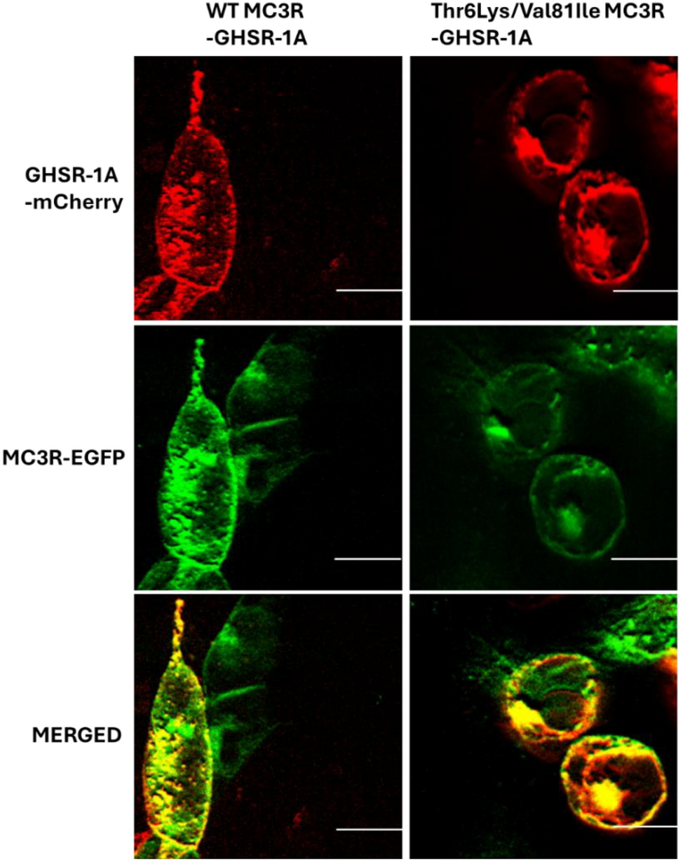 Effect of a partial loss of function  mutation on MC3R+GHSR-1A heterodimer activity and RNF11 regulation