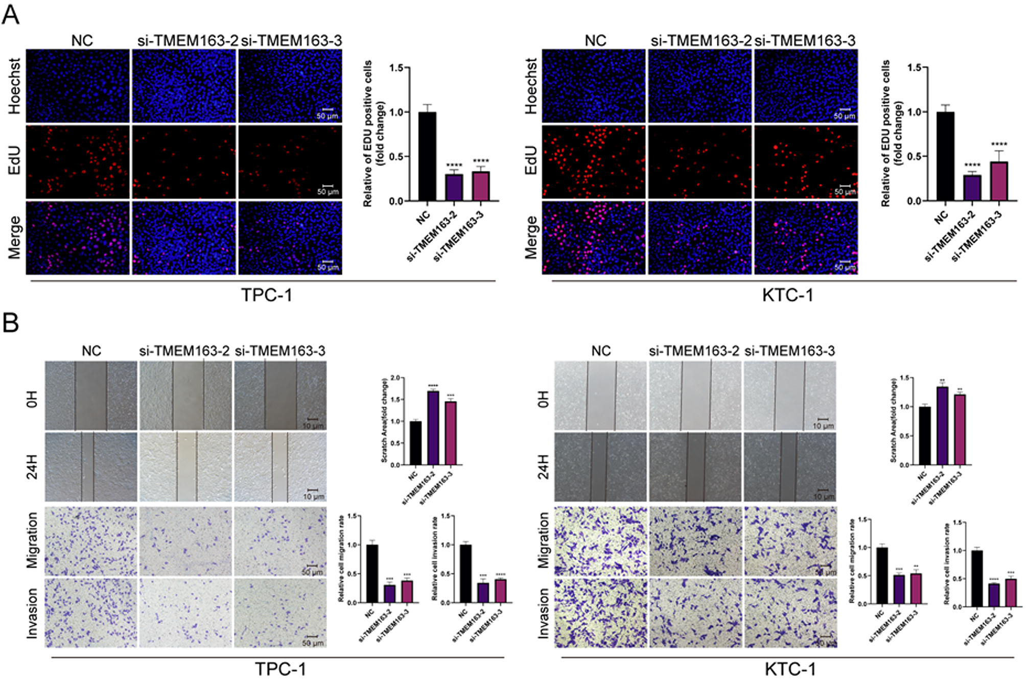 Correction: The role of TMEM163 protein in thyroid microcarcinoma: expression pattern and clinical implications