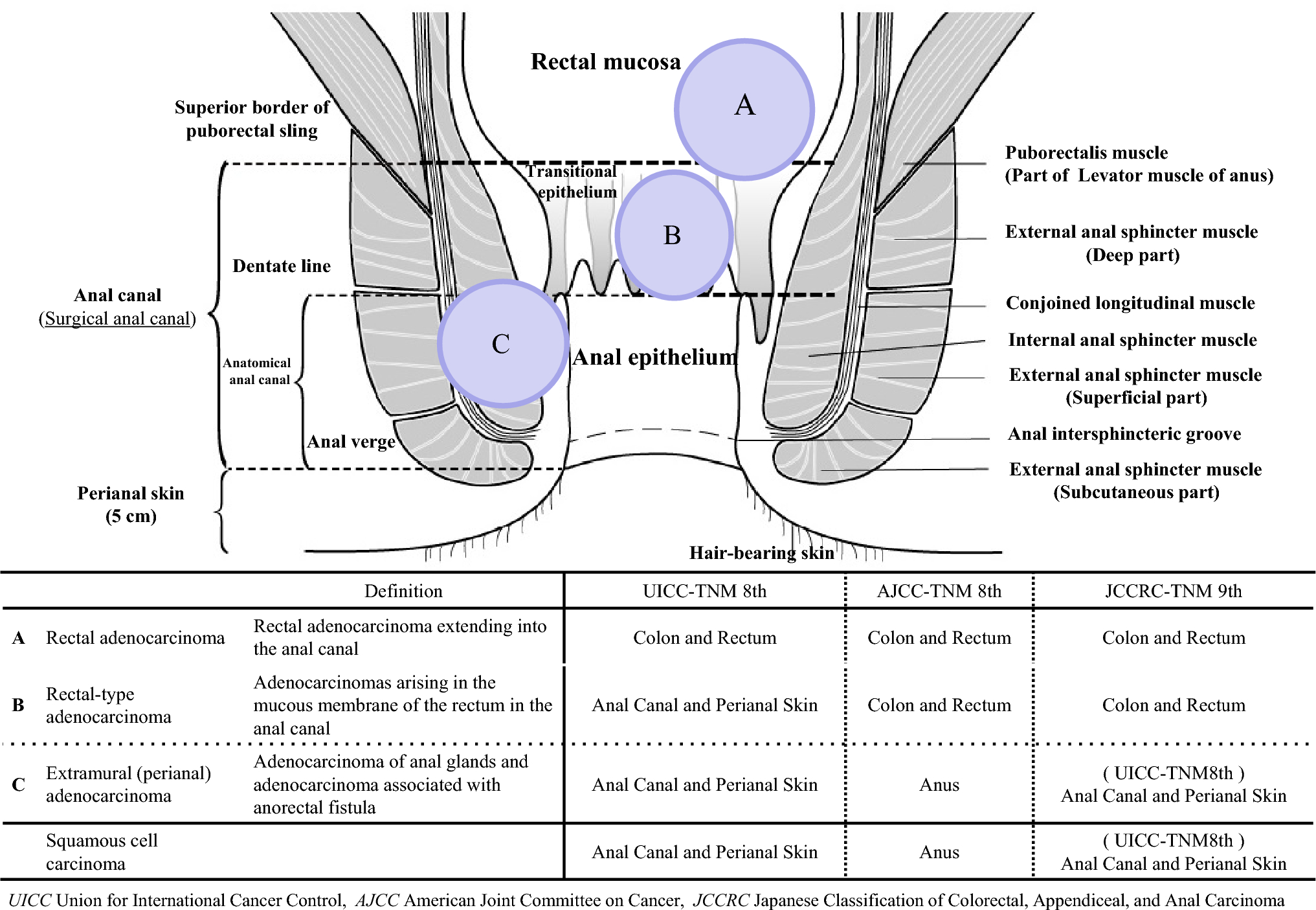 Cancer epidemiology in rare and hereditary colorectal diseases 2) anal canal cancer (cancer statistics)