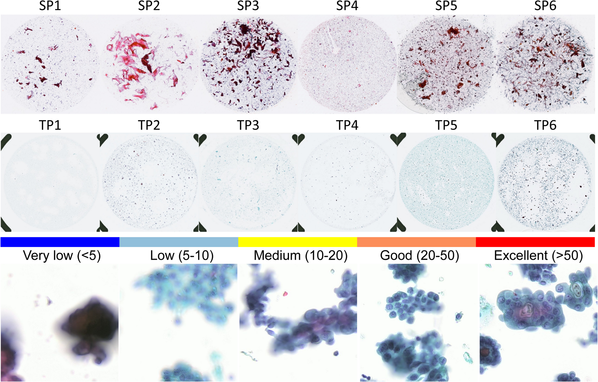 Quantitative Assessment of Focus Quality in Whole-Slide Imaging of Thyroid Liquid-Based Cytology Using Laplacian Variance