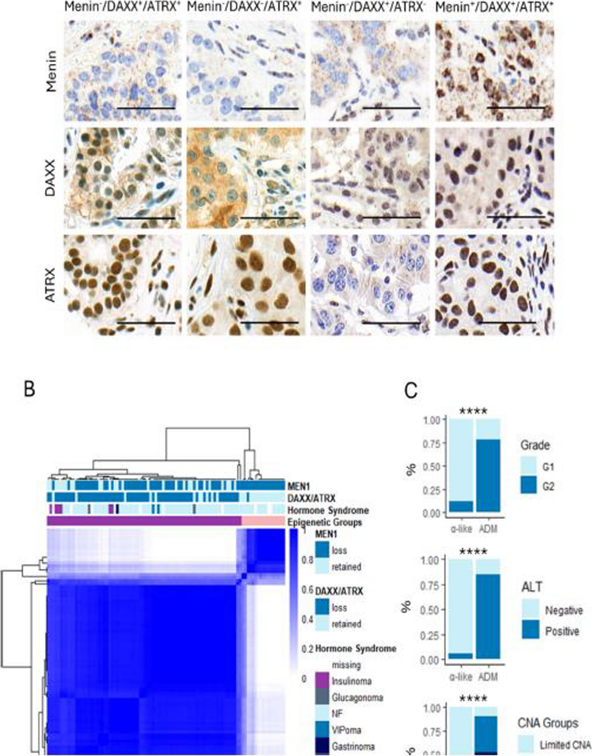 Correction to: Molecular Subtypes of Pancreatic Neuroendocrine Tumors Mutated in  Explain Biological Variability