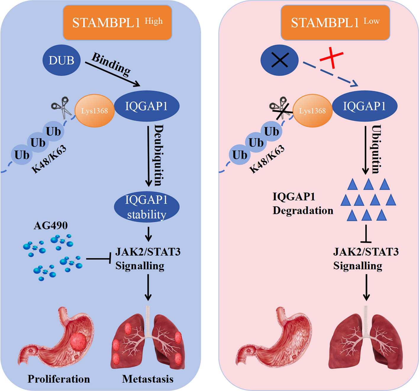STAMBPL1 promotes the progression of gastric cancer via deubiquitinating IQGAP1 to activate the JAK2/STAT3 pathway