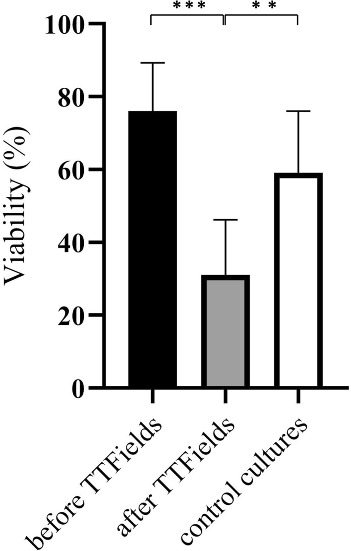 Exploratory analysis of miRNAs-21, -26a, -34a, -181c, -181d, and -485-5p as potential biomarkers for tumor treating fields sensitivity in primary glioblastoma cell cultures