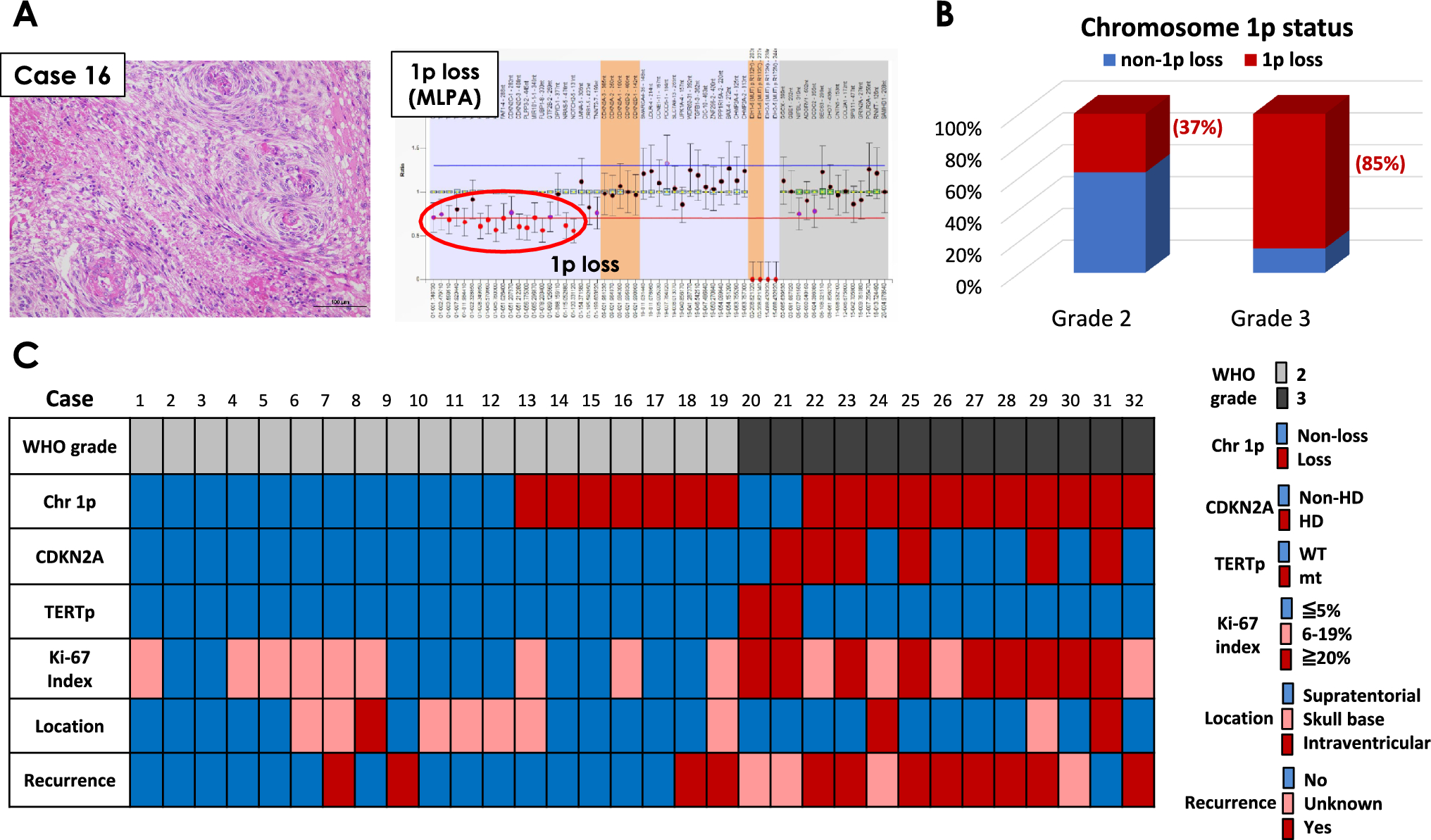 Reappraisal of novel molecular parameters for meningioma grading by cIMPACT-NOW update 8 proposals