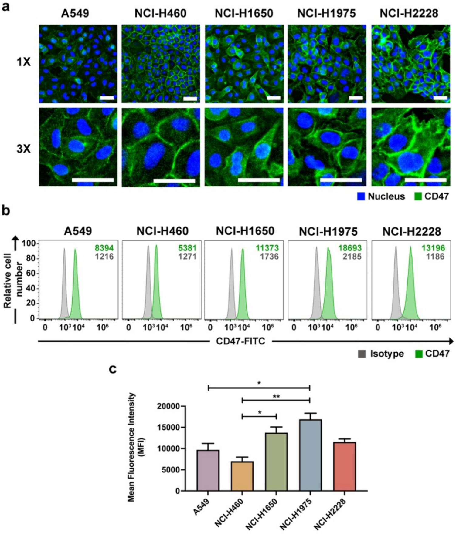 Anti-CD47 tri-specific killer engager enhances NK cell cytotoxicity against lung cancer