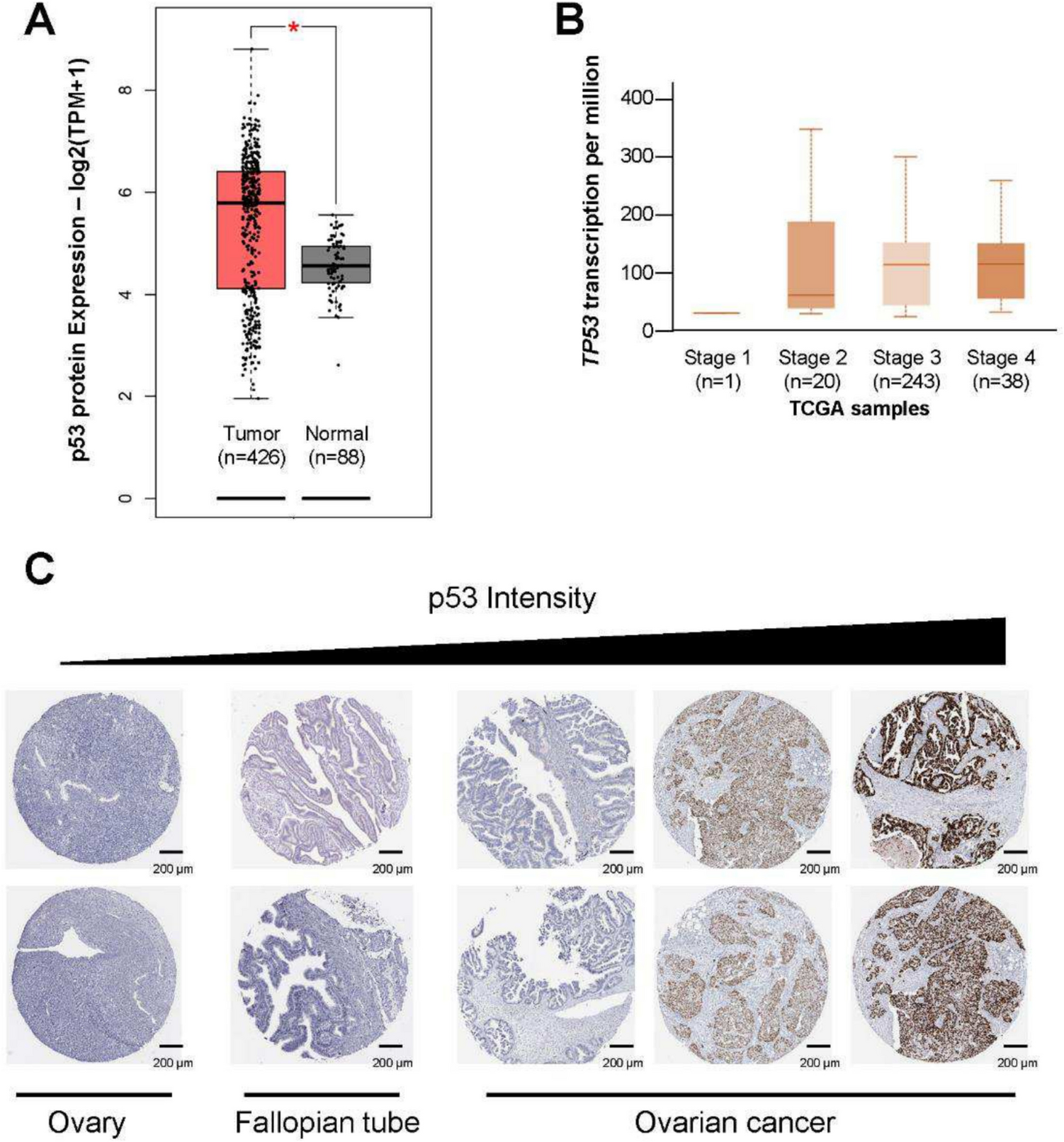 Synergistic effects of the curcumin analog HO-3867 and olaparib in transforming fallopian tube epithelial cells