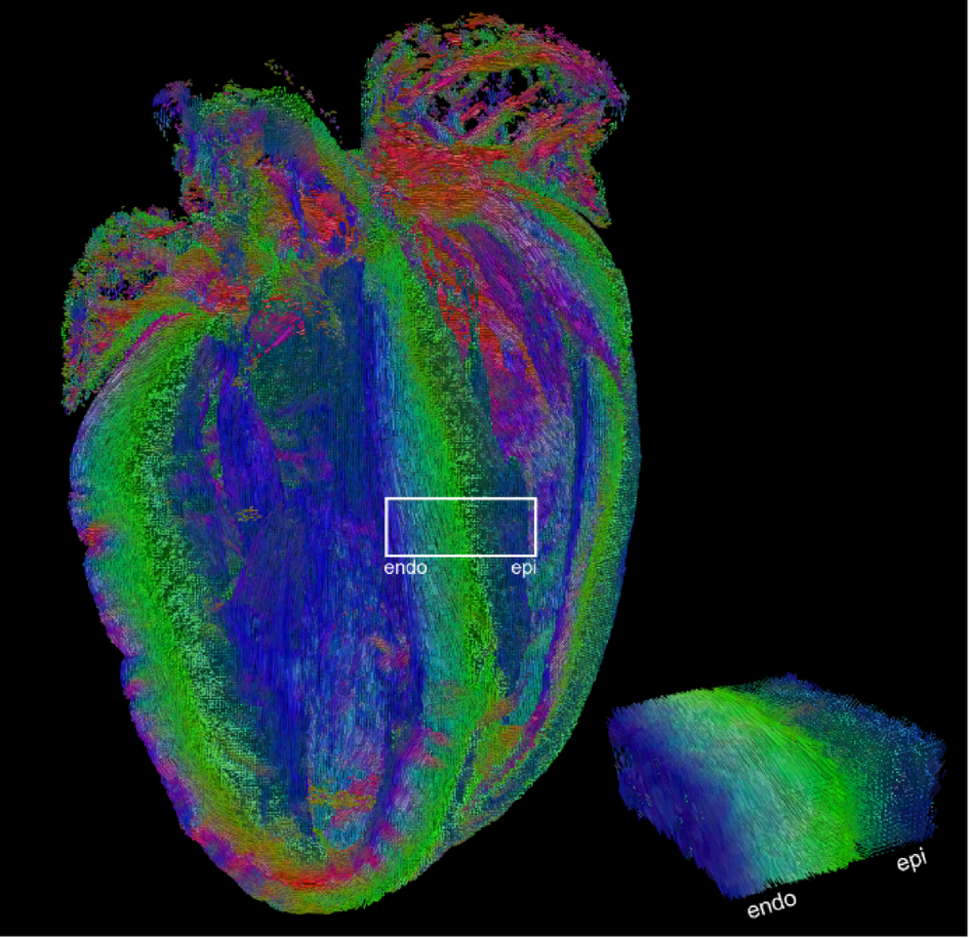 Diffusion tractography outside the brain: the road less travelled