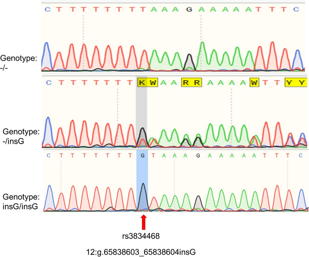 Polymorphism of the  gene in Polish children and adolescents with short stature and diverse growth hormone secretion