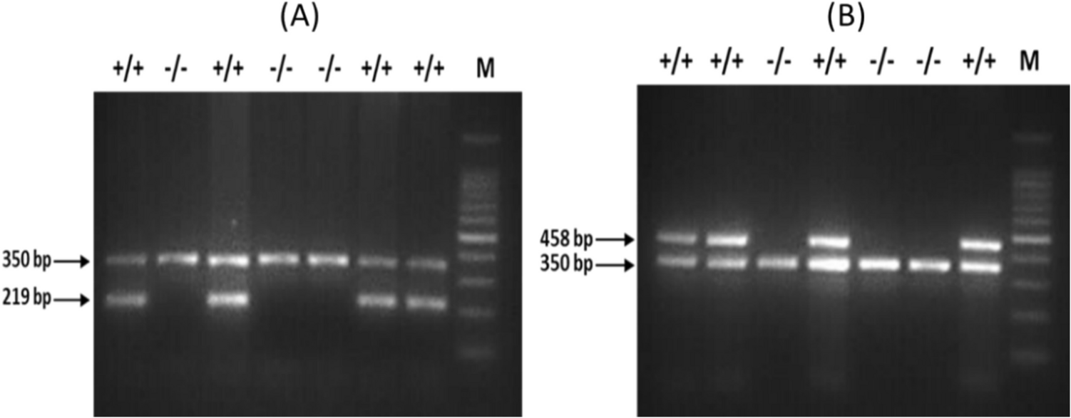 Association of polymorphisms of antioxidants (GSTM1/T1) and inflammation-related genes (CXCL8, IL-33, and IL-6) with chronic obstructive pulmonary disease (COPD)