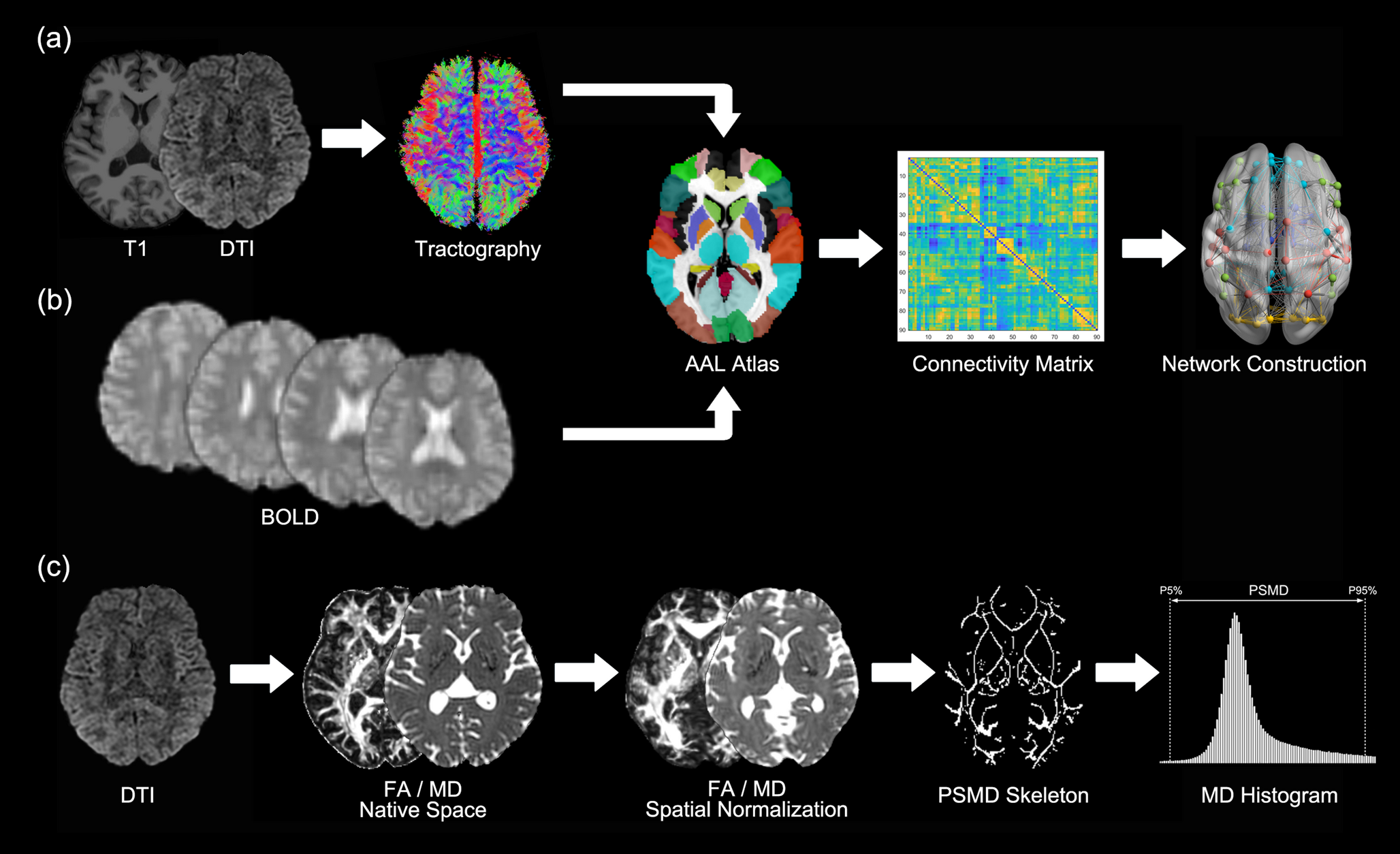 Cerebral network topology and peak width of skeletonized mean diffusivity changes associated with cognitive impairment in patients with obstructive sleep apnea