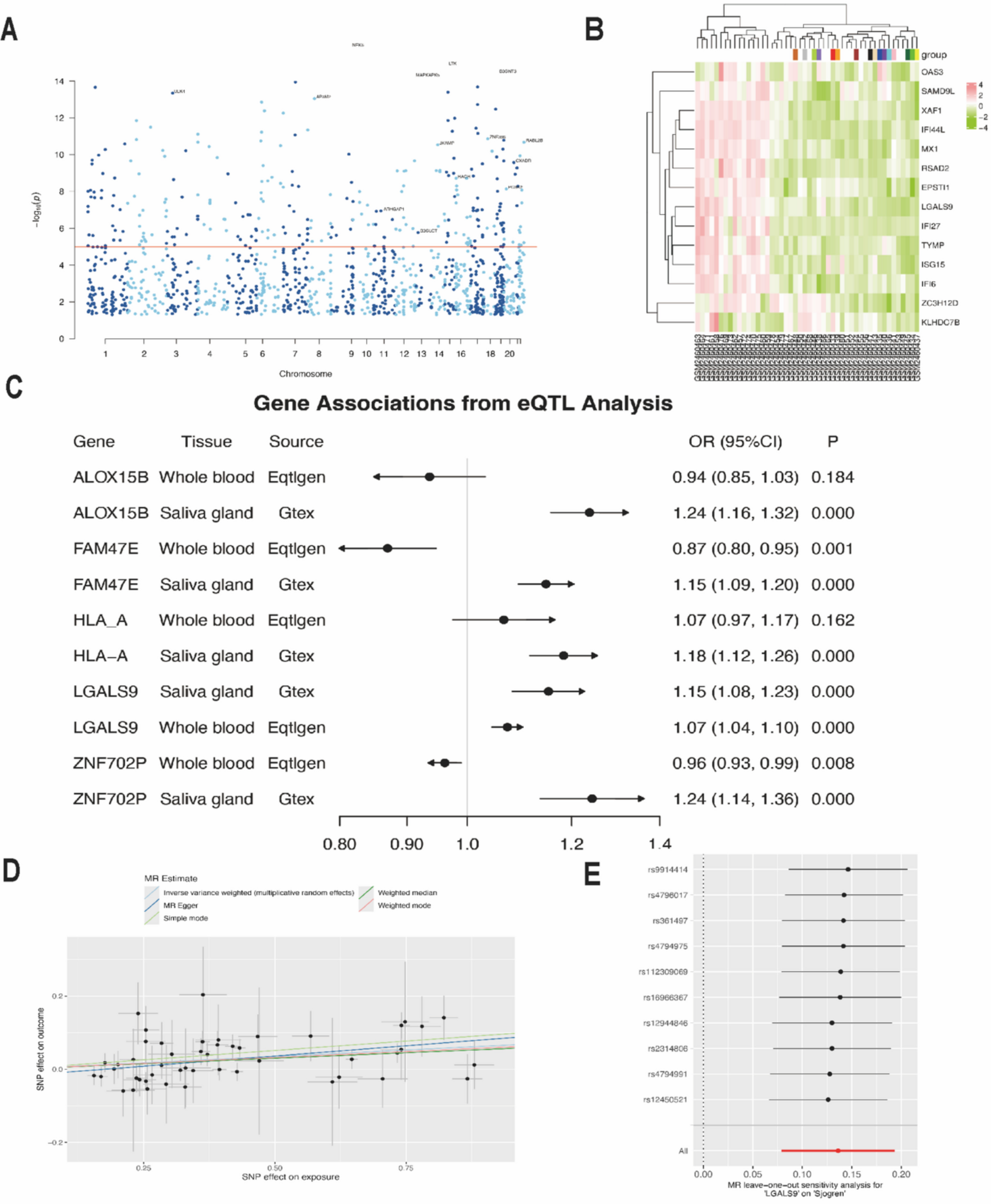 Galectin-9 potentiates salivary gland damage by inducing ferroptosis in Sjogren’s disease