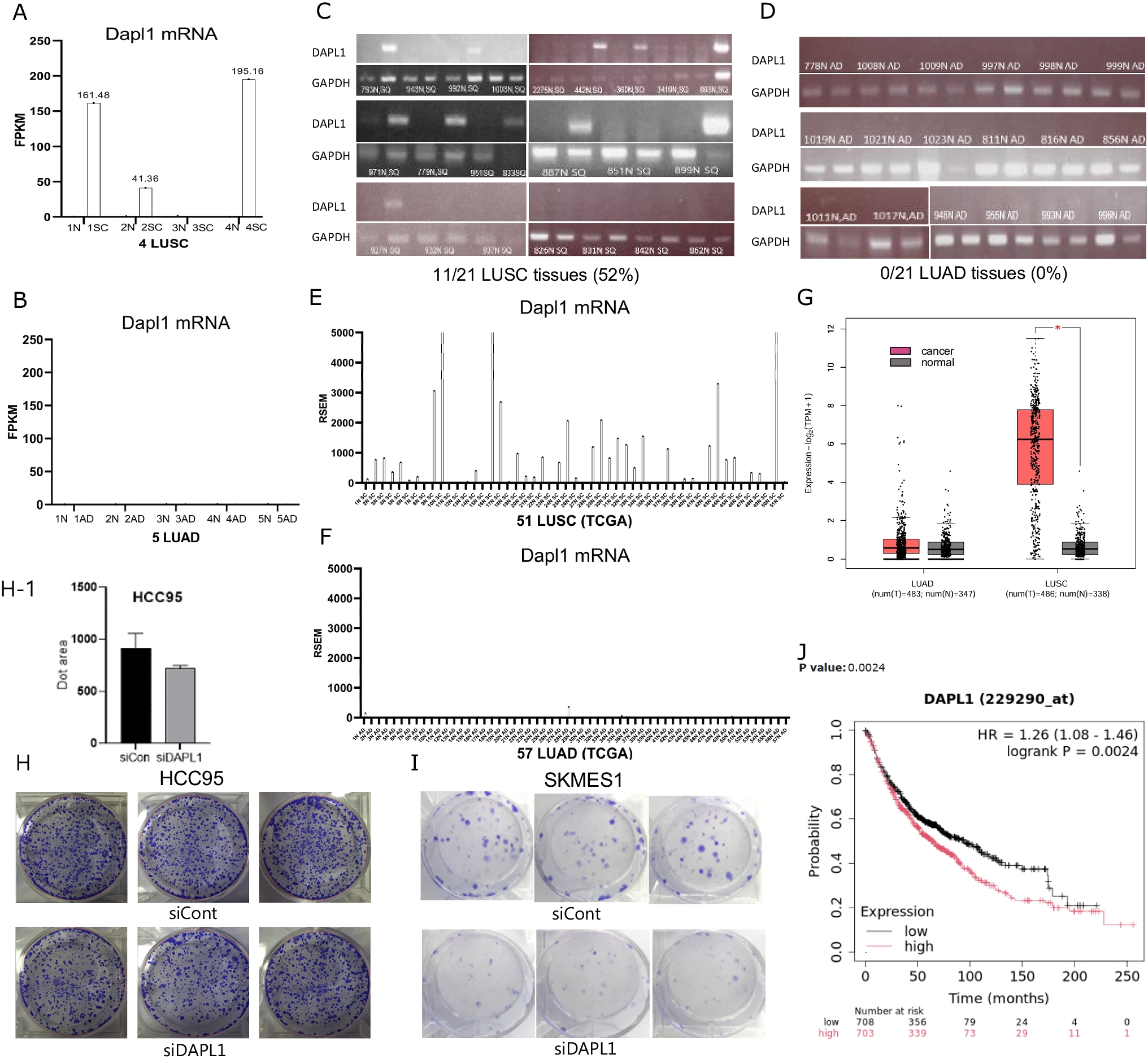 DAPL1 is activated by Np63 and GRα and regulates lipid metabolism