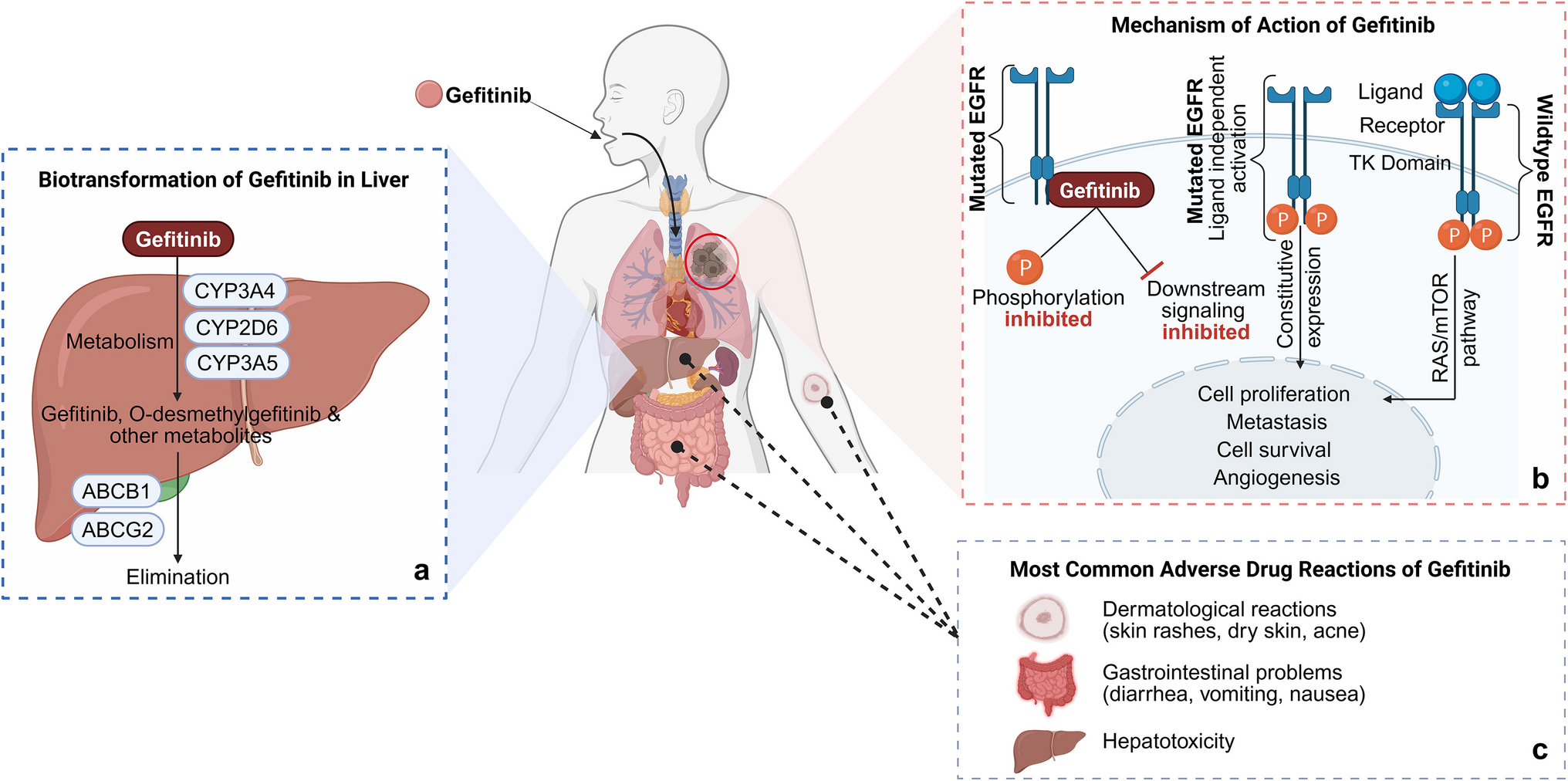 Influence of genetic polymorphisms on gefitinib pharmacokinetics and adverse drug reactions in non-small cell lung cancer patients