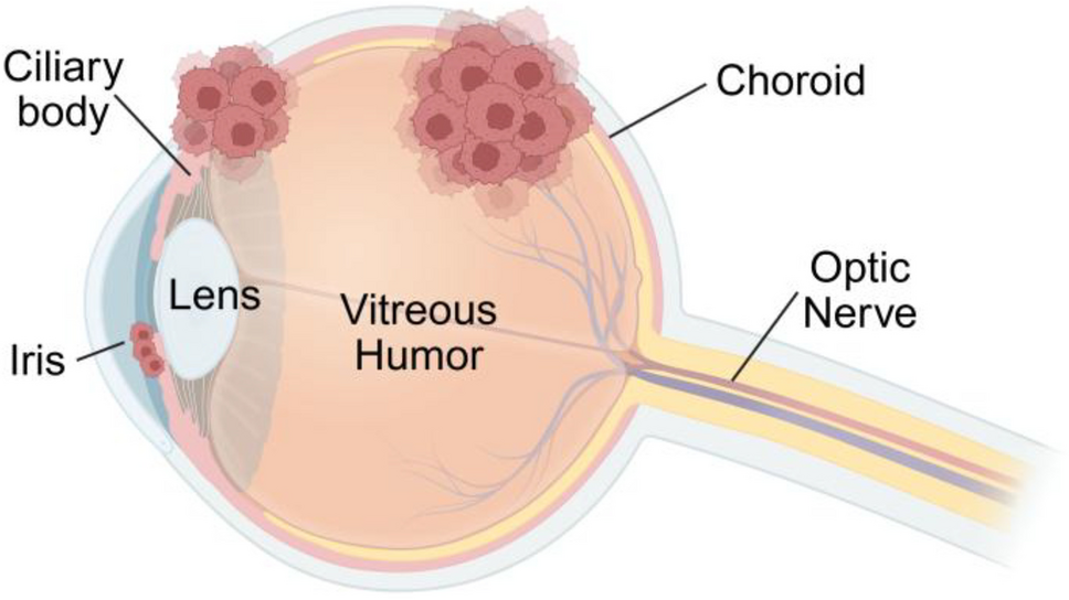 Functions and clinical implications of the liver microenvironment in hepatic uveal melanoma metastases