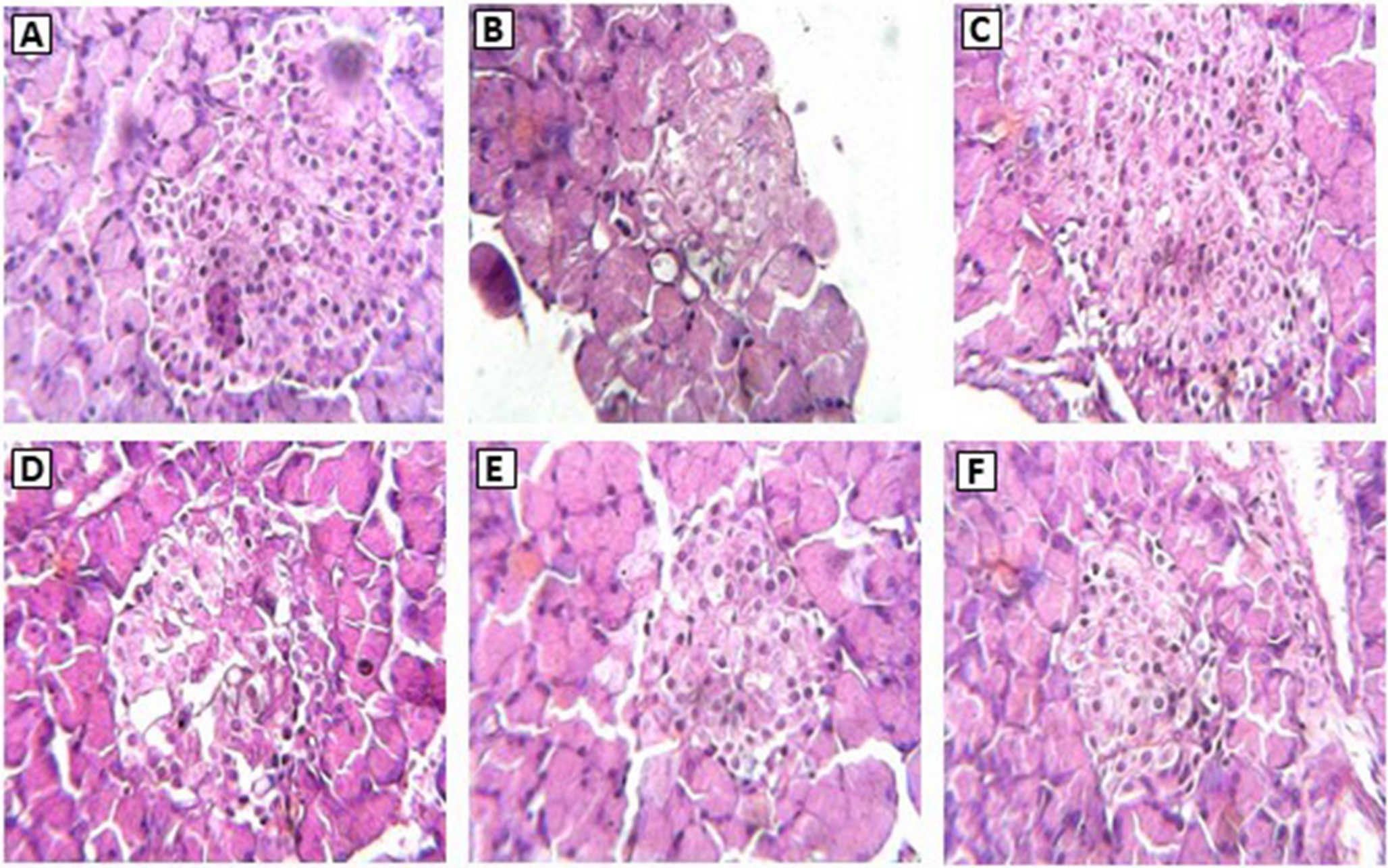 Antidiabetic Activity of  L. Root Fractions in Streptozotocin-Induced Diabetic Rats and Activity-Guided Phytochemical Correlation