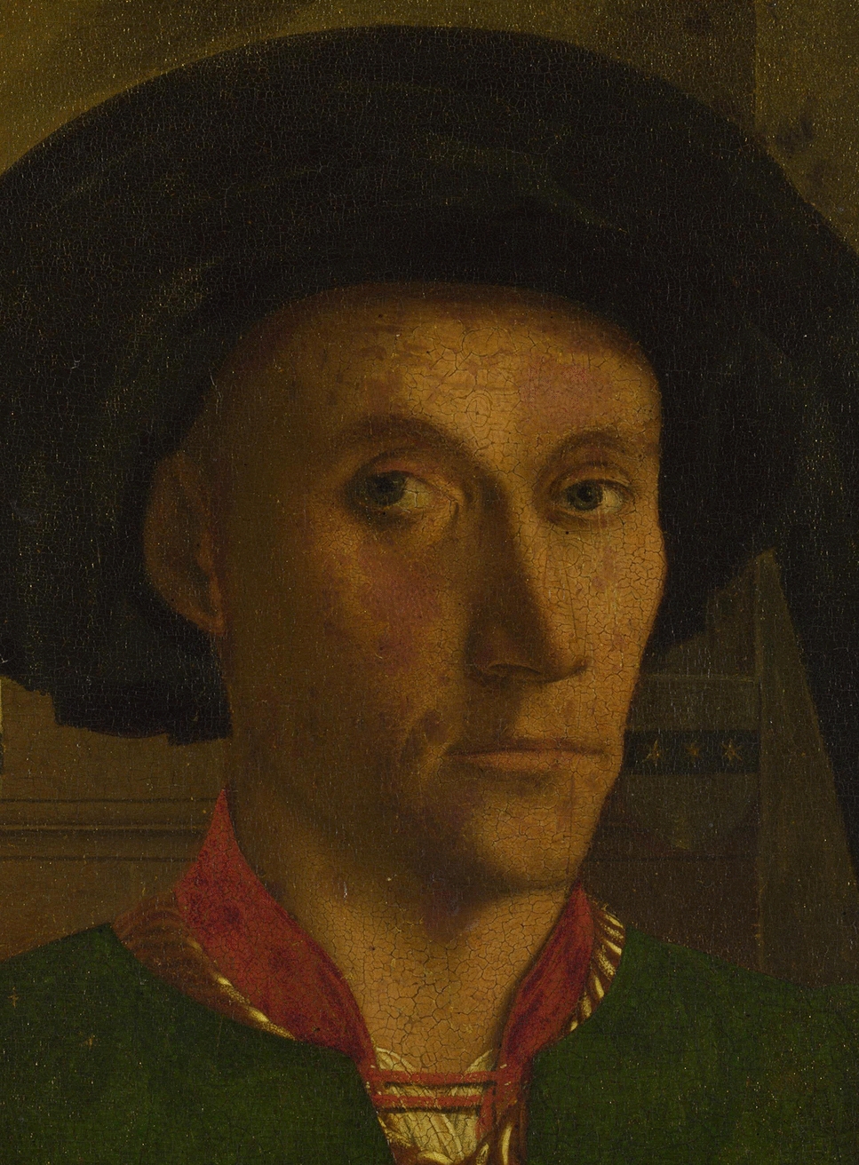 Lack of dermatological signs in the portrait of Edward Grimston (fifteenth century)