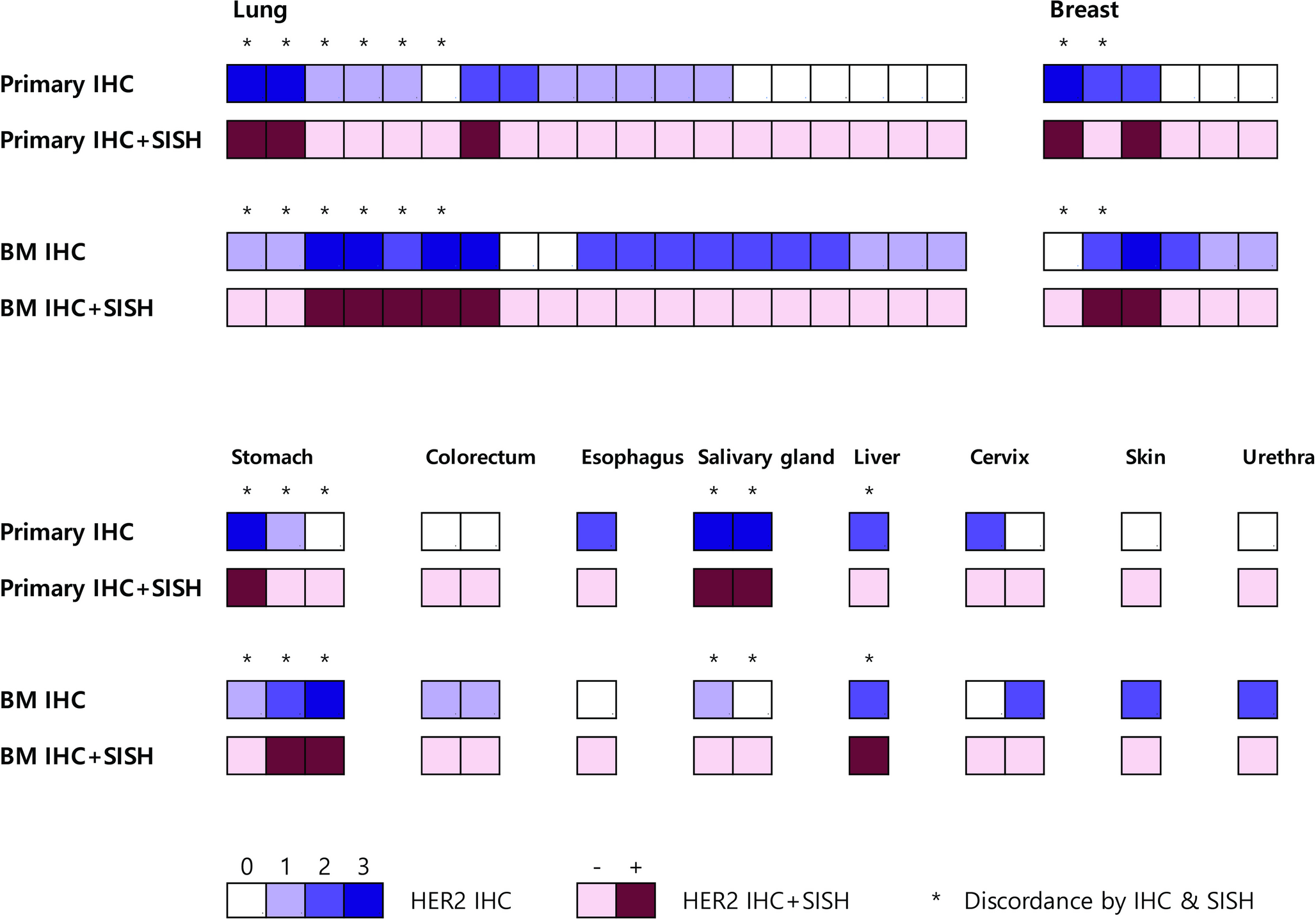 HER2 heterogeneity between primary cancers and brain metastases: a retrospective analysis of 185 matched pairs across multiple cancer types