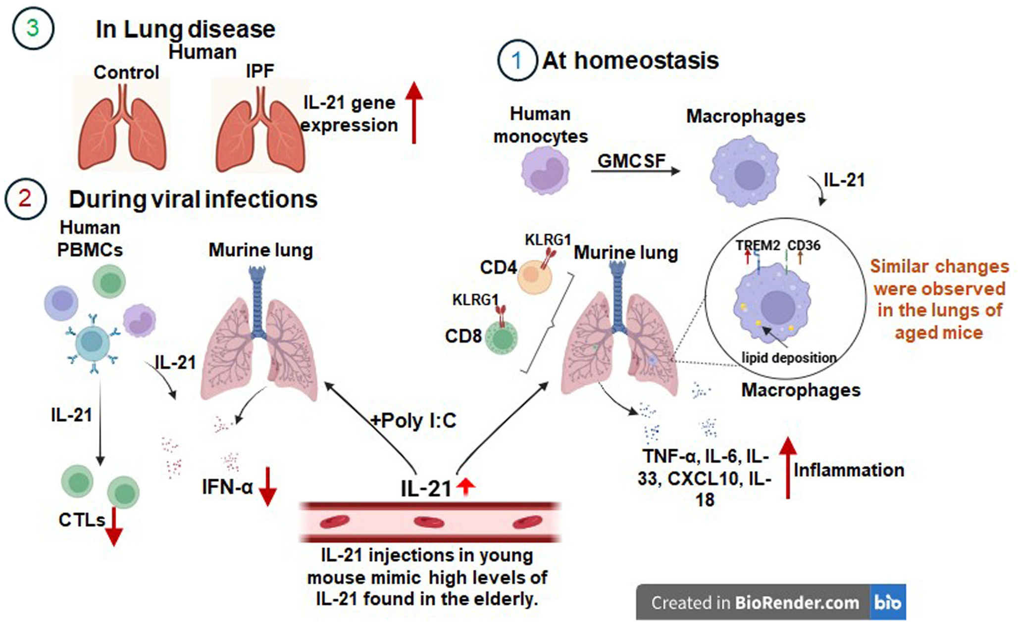 Chronic IL-21 exposure reshapes pulmonary environment, elevating risk of respiratory diseases