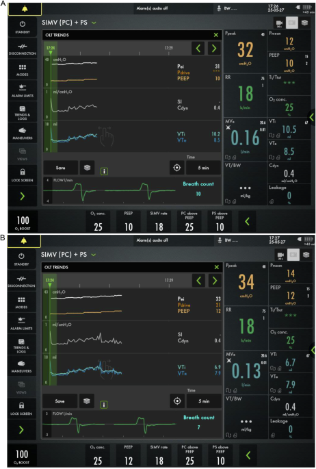 A non-invasive diagnostic tool for the assessment of optimal positive-end expiratory pressure (PEEPOPT) in infants receiving prolonged invasive ventilation