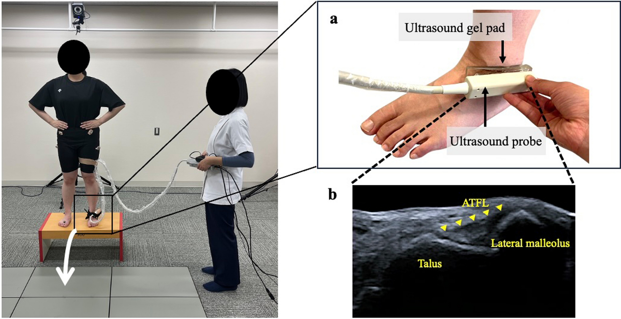 Quantitative dynamic evaluation of the talus–lateral malleolus distance during forward single-leg drop landing in individuals with chronic ankle instability: a cross-sectional study