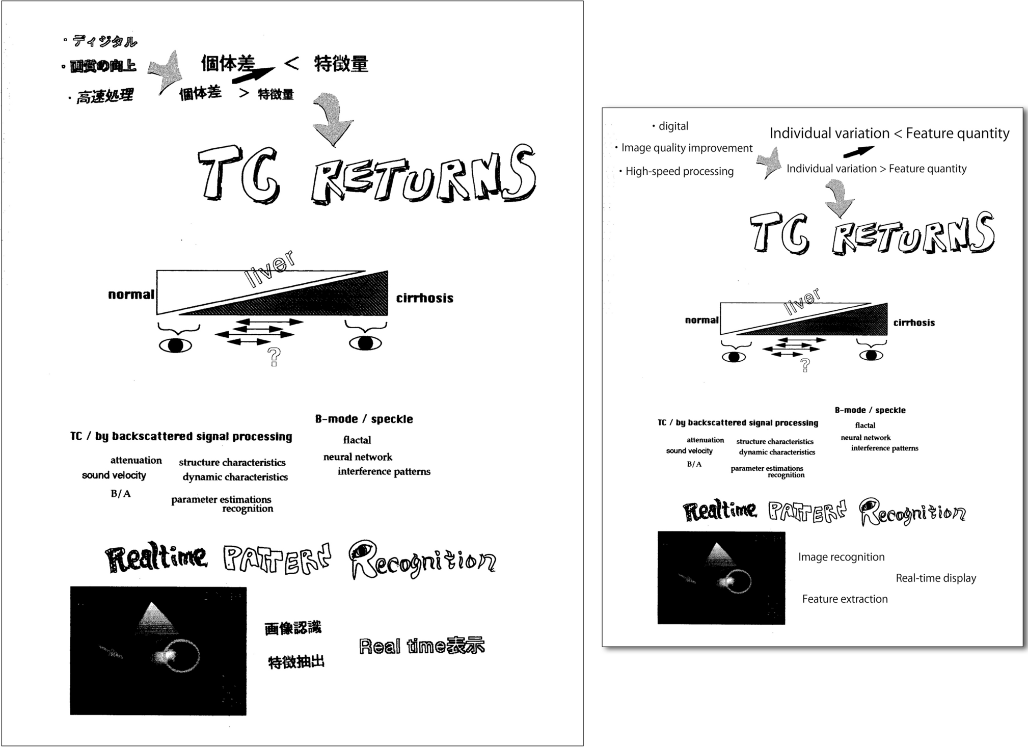 A review of my history of research on ultrasound tissue characterization of chronic liver disease for developing ultrasound clinical technology
