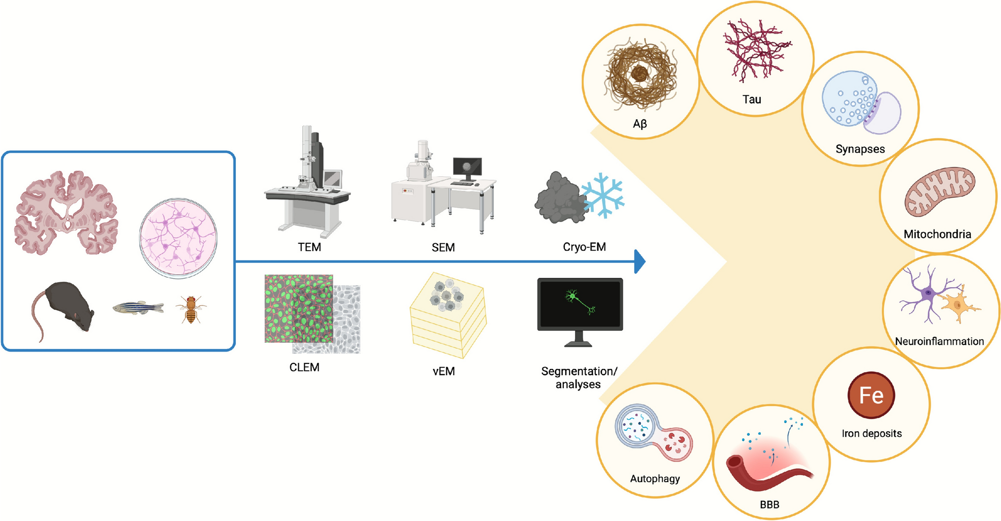 Digging Deep into Alzheimer Disease: How Electron Microscopy Helps Elucidating Its Pathogenesis