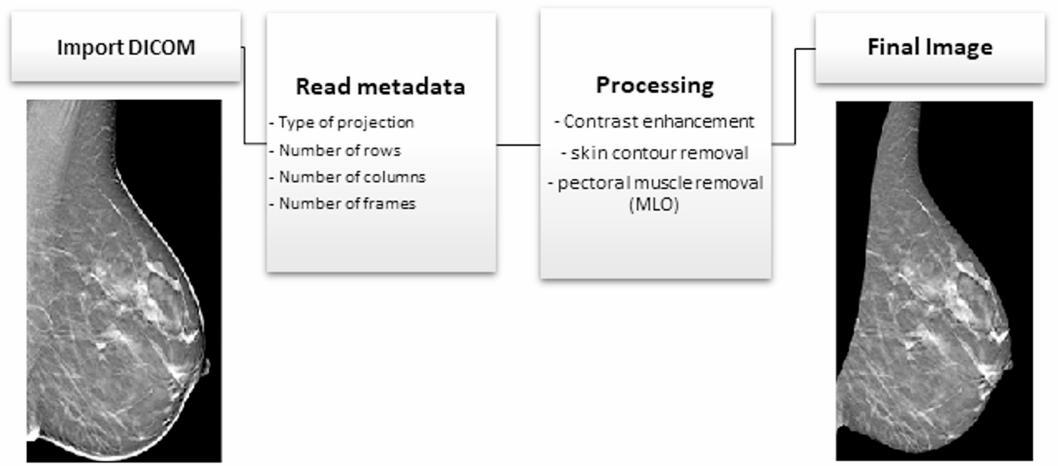 DBT_DCNN: a new convolutional neural network for mass detection in digital breast tomosynthesis