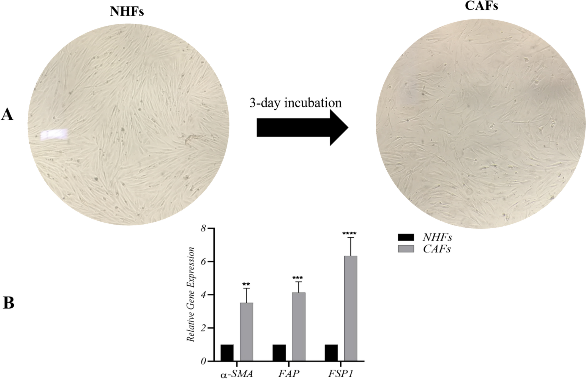 Photobiomodulation mitigates the inhibitory effects of pirfenidone on cancer-associated fibroblasts and their pro-tumorigenic properties: a cause for concern