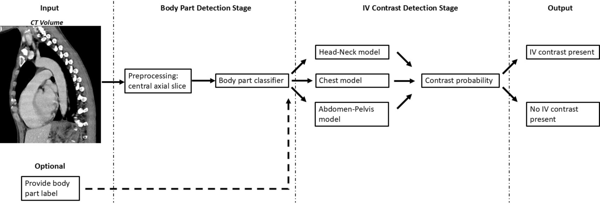 Open-Access Fully Automated Intravenous Contrast Detection and Body Part Classification for Computed Tomography Scans: The FALCON Model