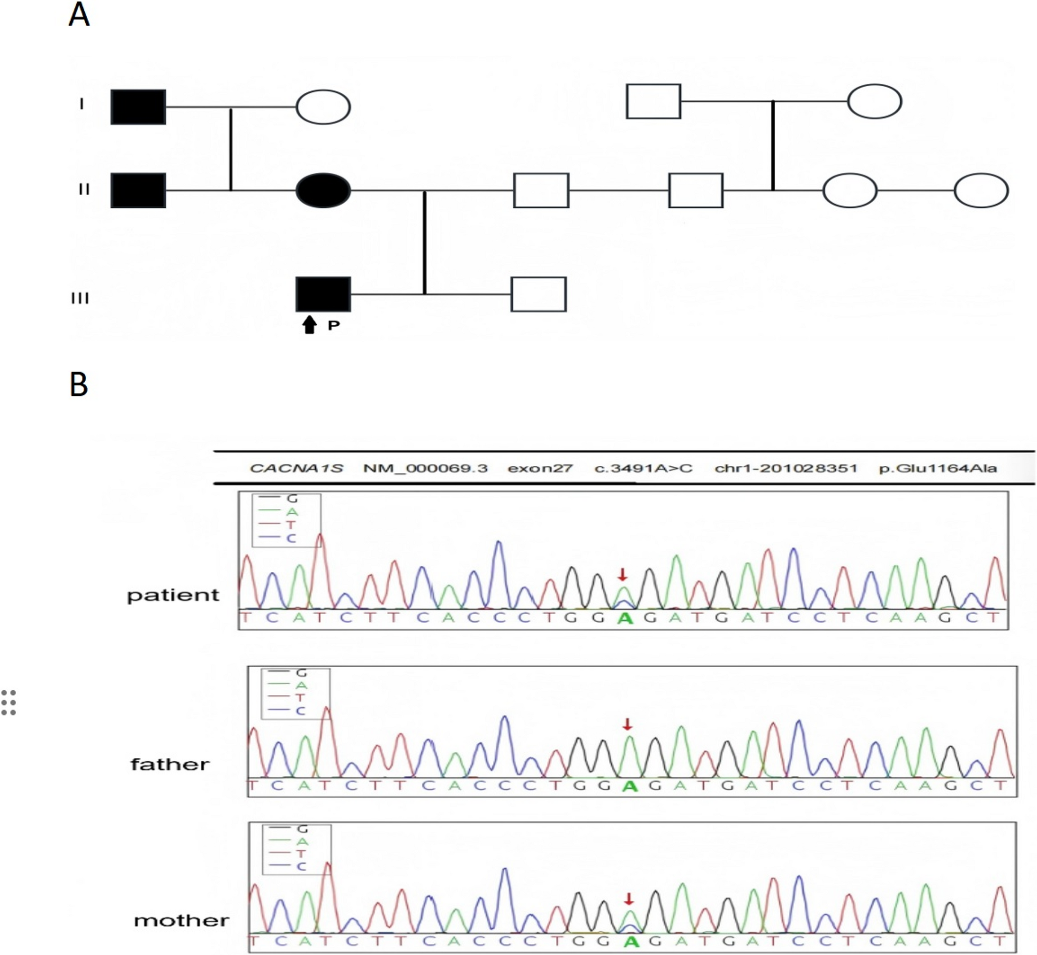 Novel  Mutation  in Hypokalemic Periodic Paralysis: First Report with Functional Validation