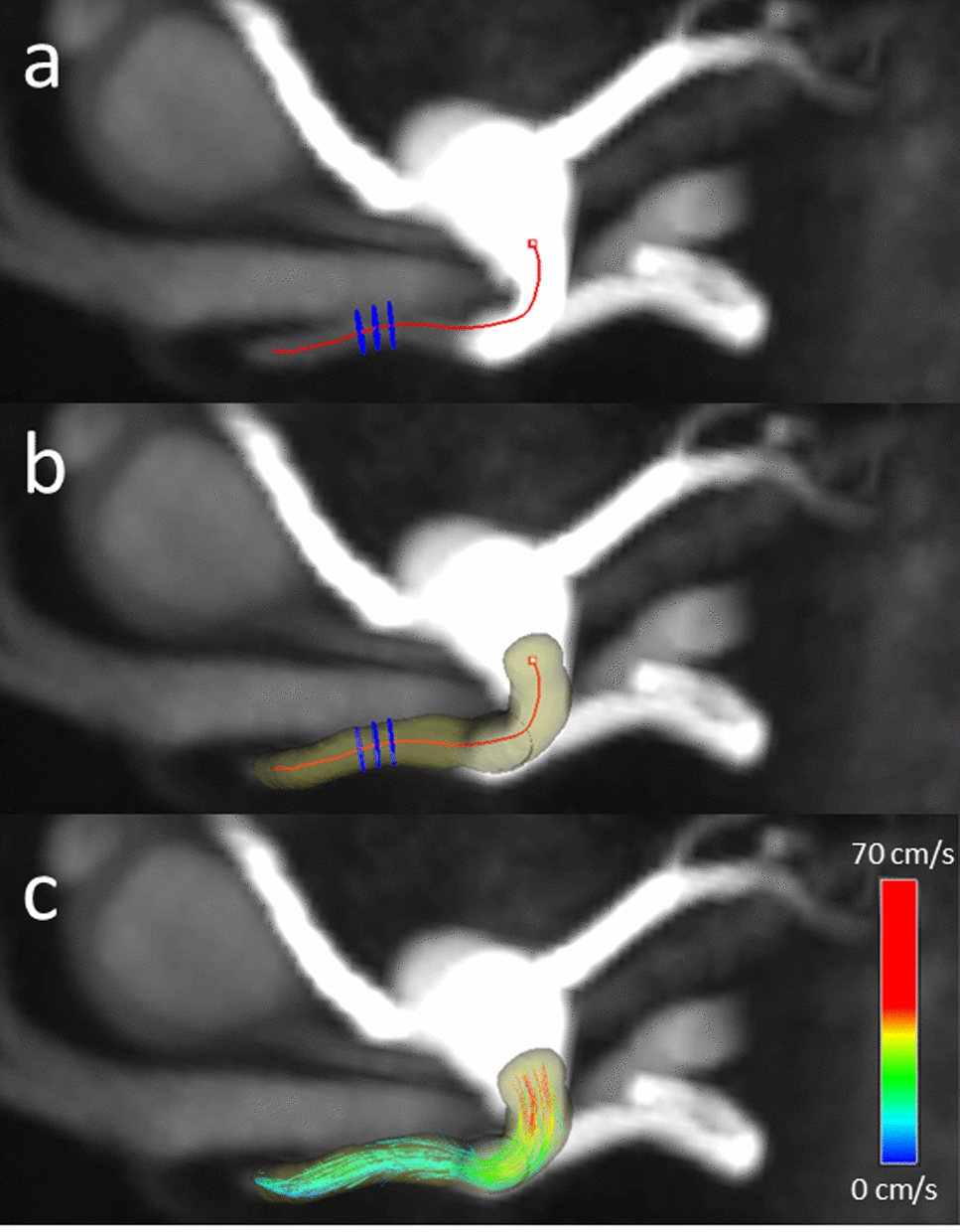 Quantifying hepatic arterial blood flow with 4D flow MRI: an in vivo feasibility and repeatability study