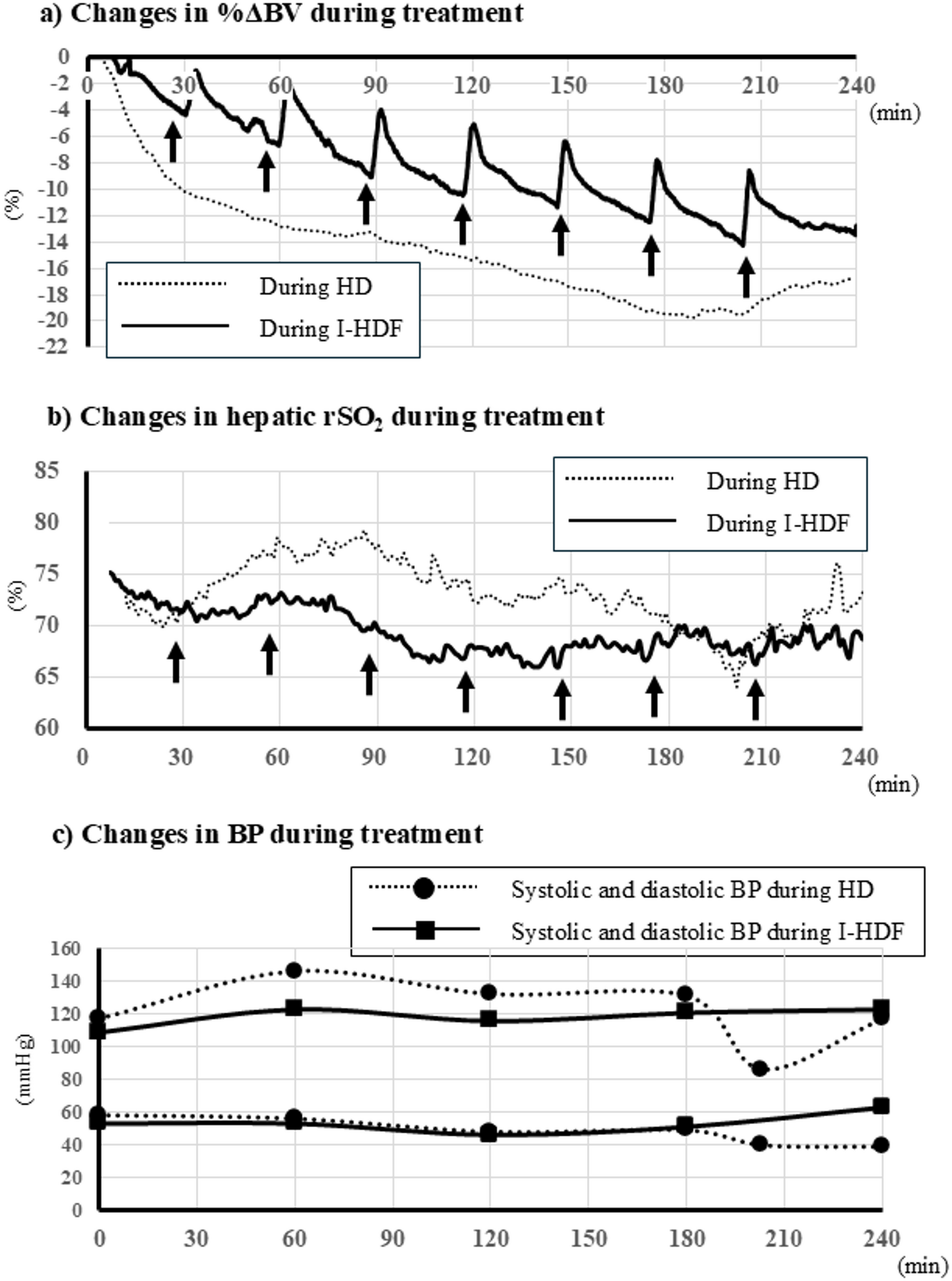 Resolution of intradialytic hypotension and changes in hepatic oxygenation following the transition from hemodialysis to intermittent infusion hemodiafiltration: a case report