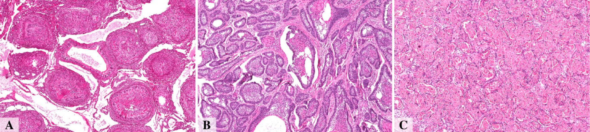Impact of Transfer Learning on Convolutional Neural Networks for Odontogenic Tumor Diagnosis