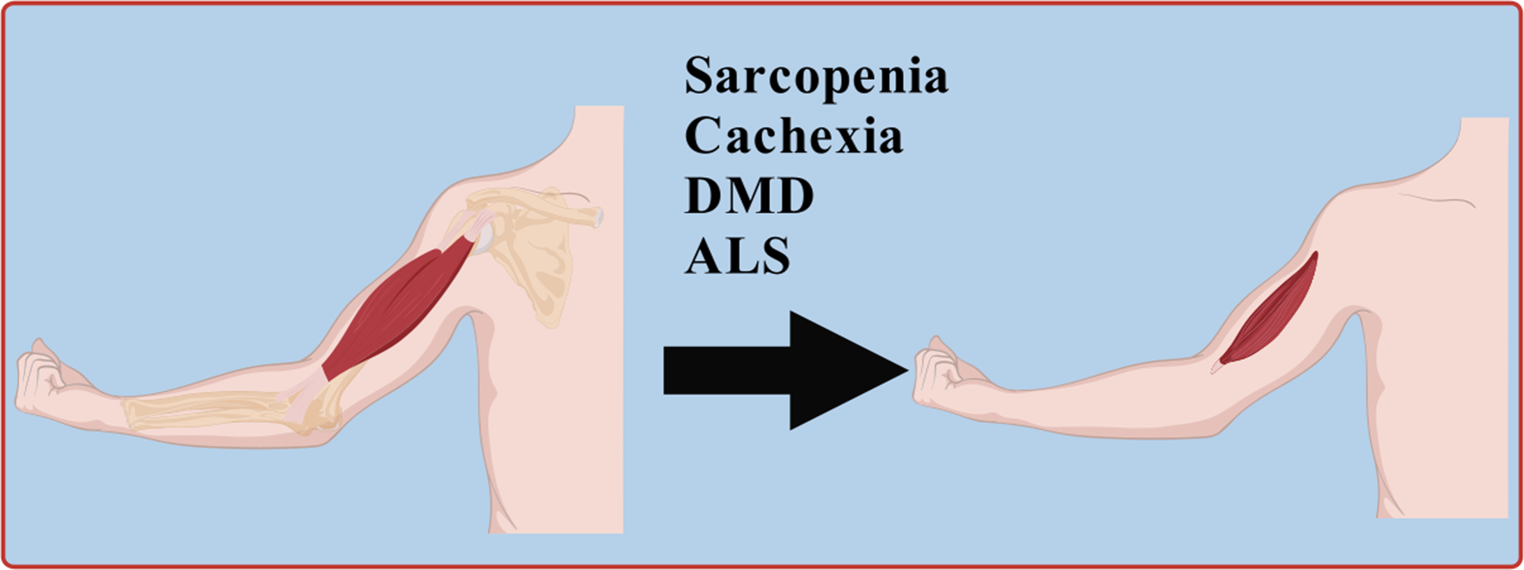 Calcium homeostasis dysregulation and muscle atrophy: multidimensional regulation from excitatory contractile coupling to sarcoplasmic reticulum stress