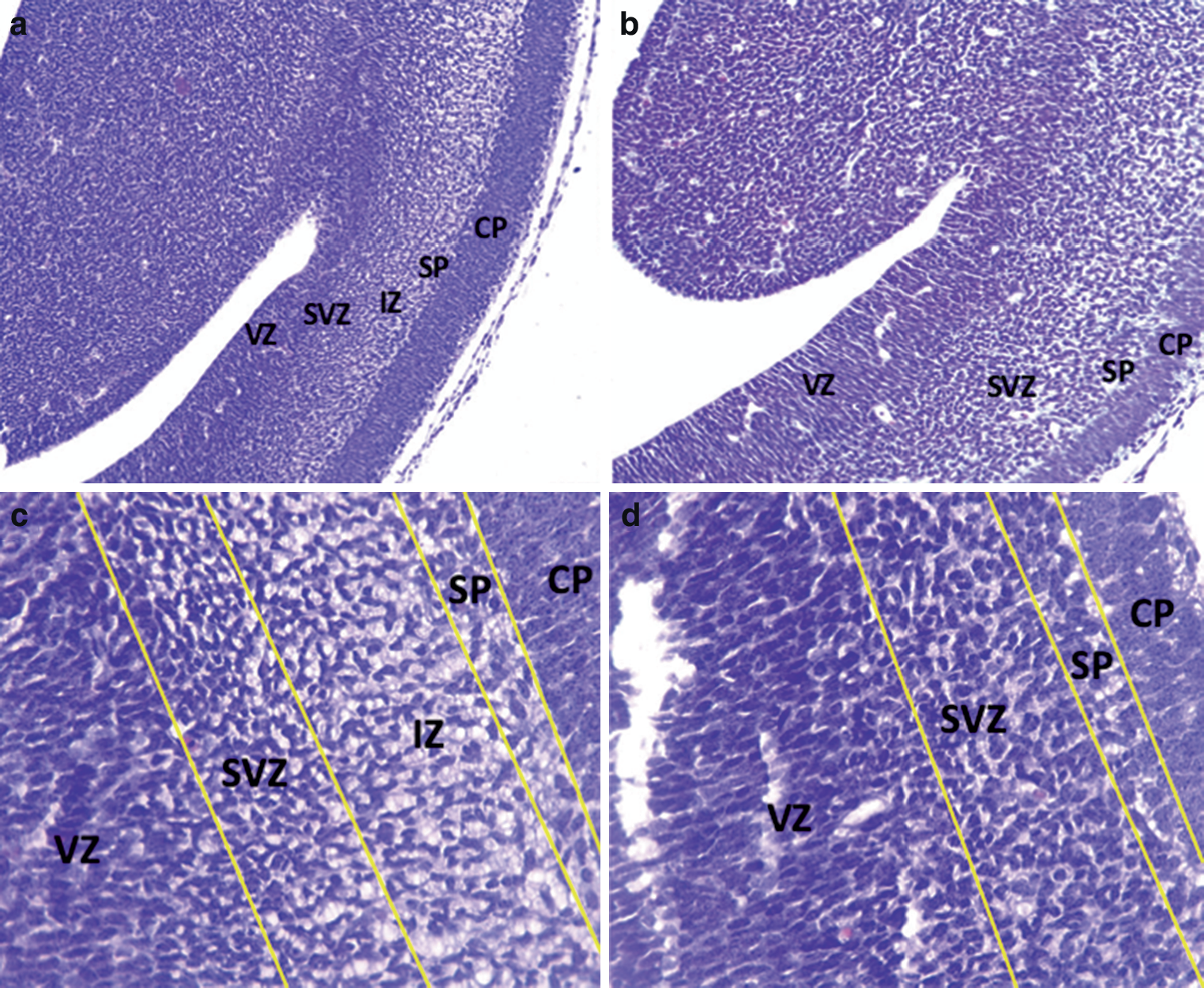 In utero exposure to Bisphenol S impairs neurodevelopment in mice
