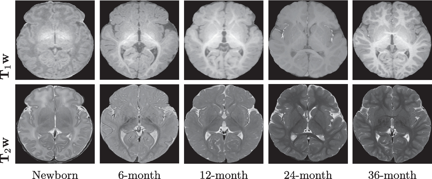 Dual-Modal Deep Learning with In-Domain Training and Attention for Infant Brain Myelination Prediction