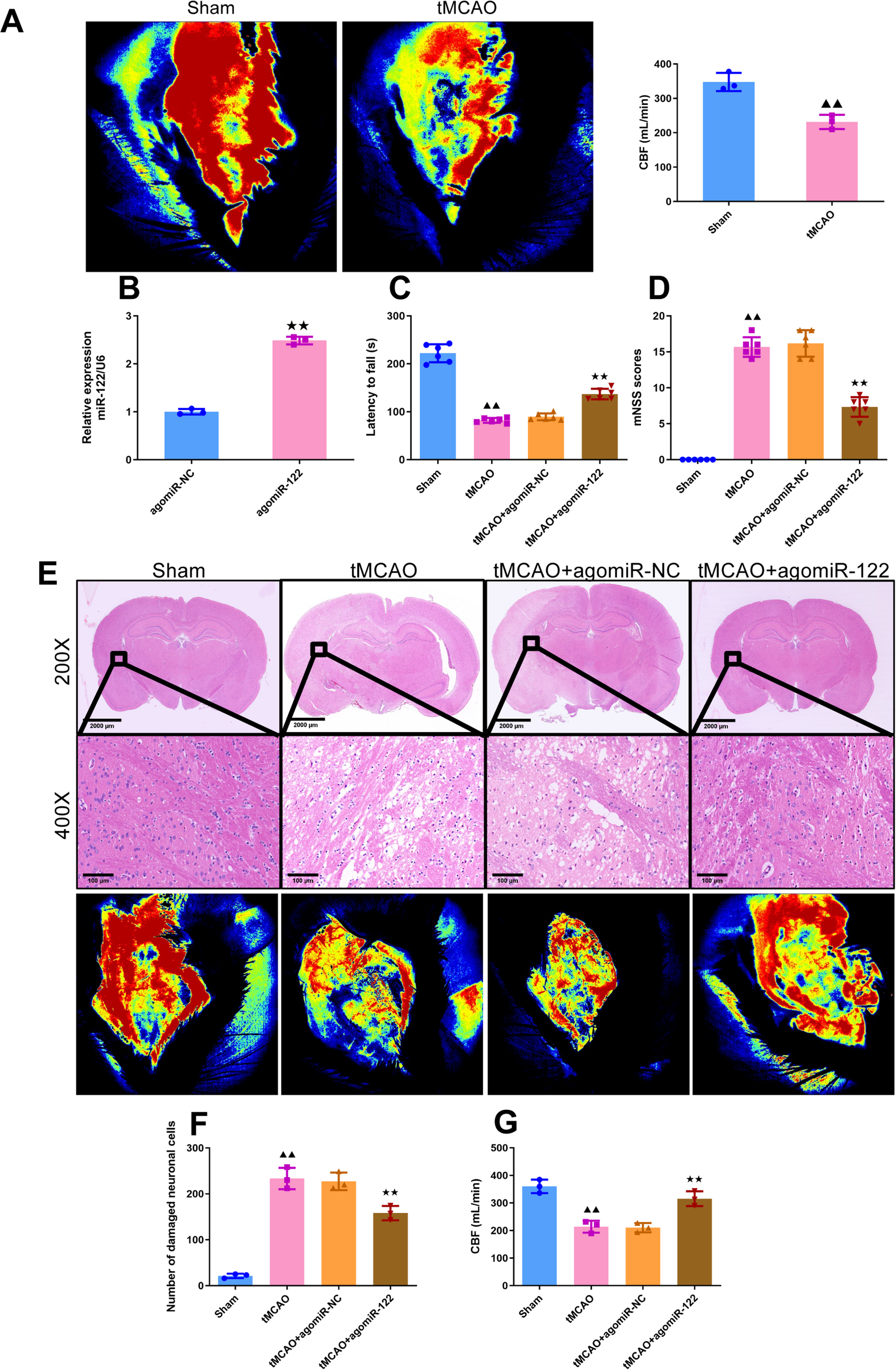 MiR-122 activates PI3K/Akt signaling to suppress microglial activation and ferroptosis in ischemic brain injury